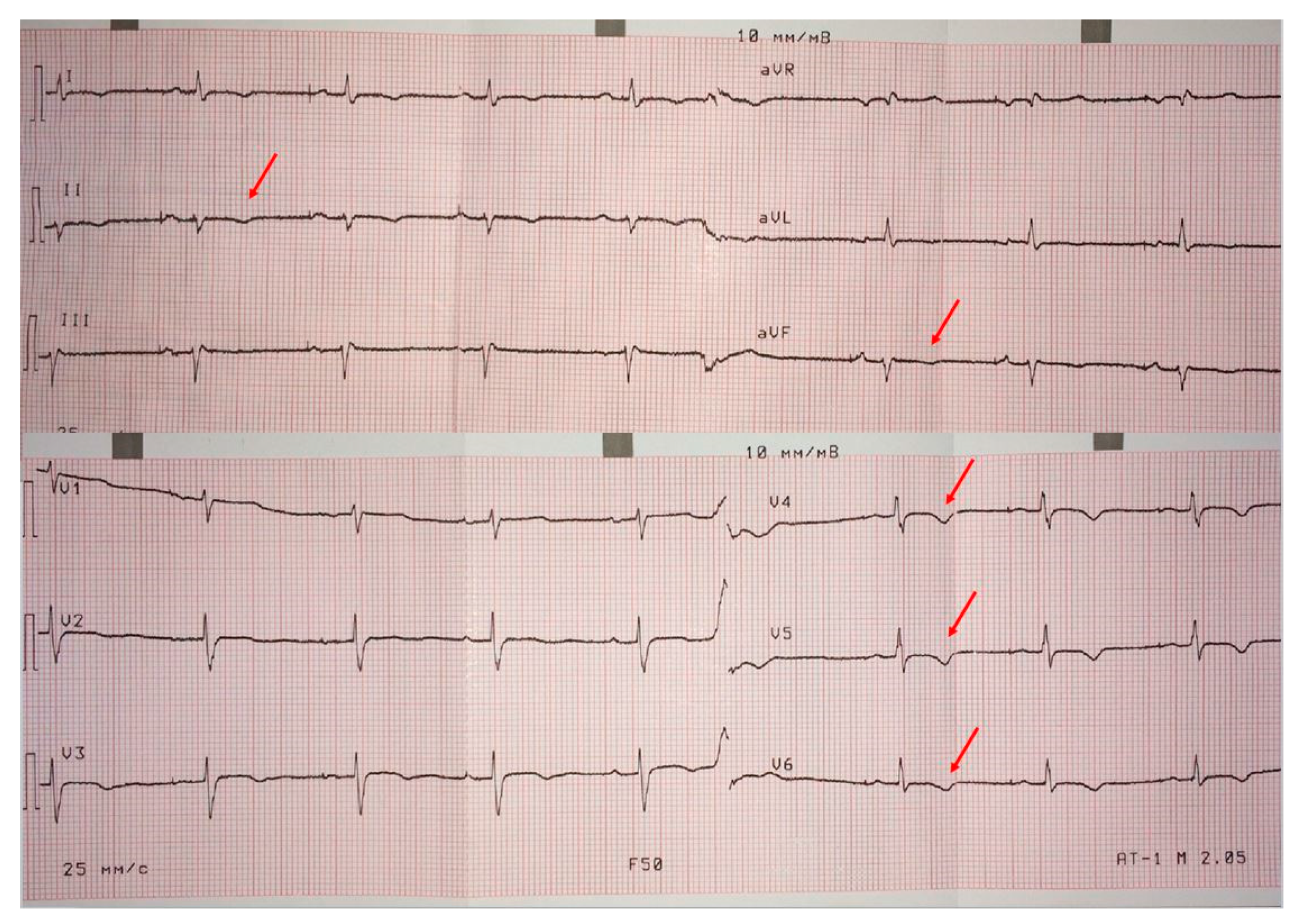 Cardiogenetics 11 00003 g002 Cardiogenetics 11 00003 g002