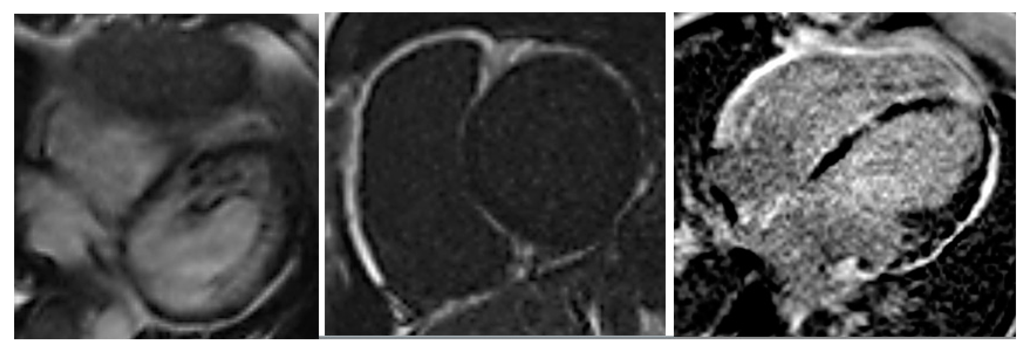 Cardiogenetics 11 00003 g003 Cardiogenetics 11 00003 g003