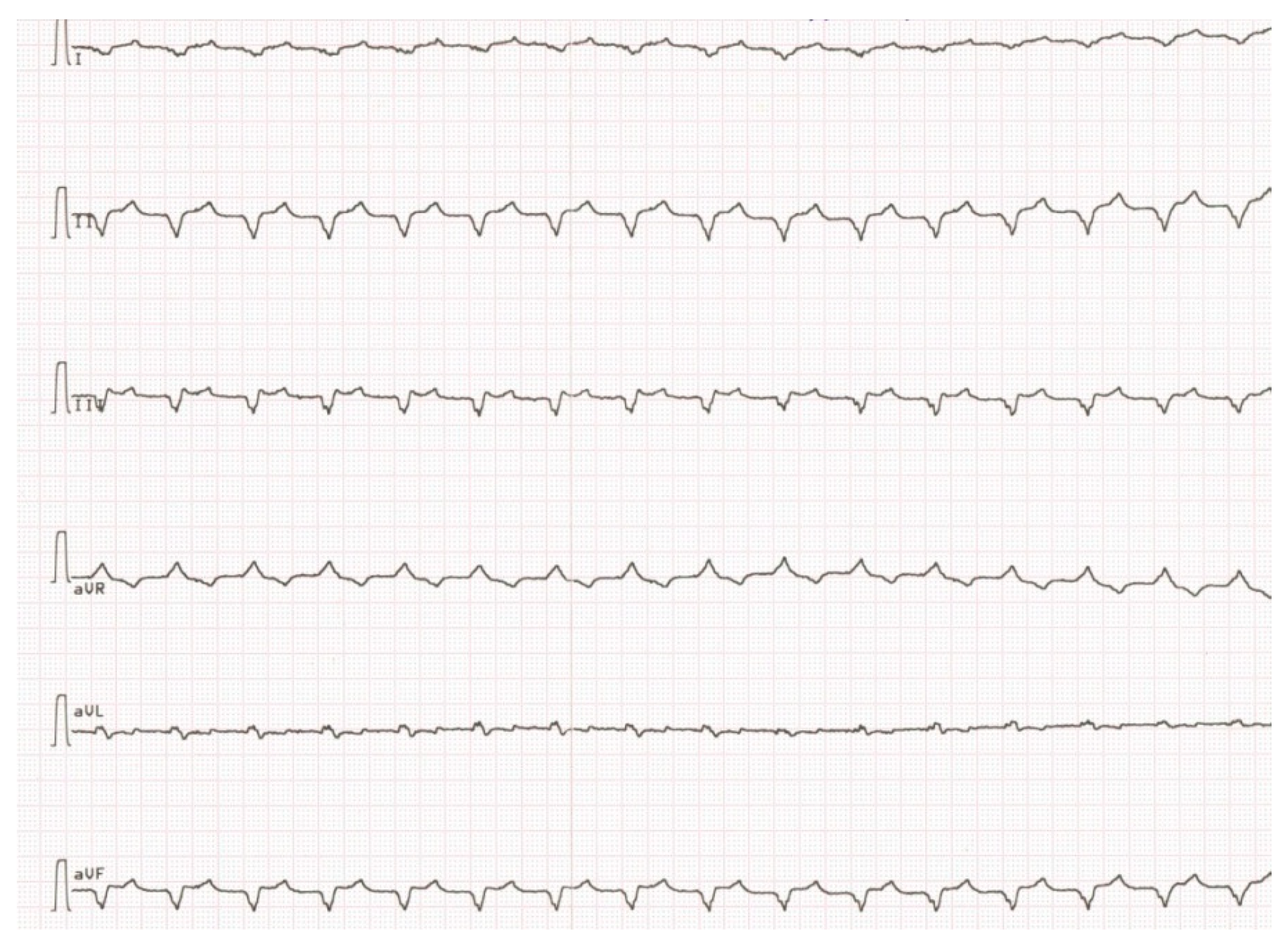Cardiogenetics 11 00003 g004 Cardiogenetics 11 00003 g004