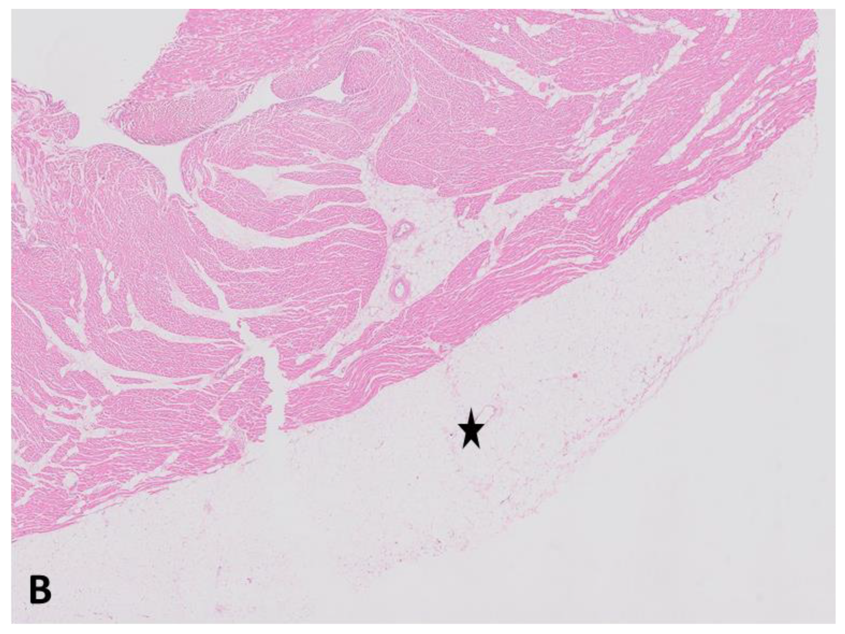Cardiogenetics 11 00008 g002b