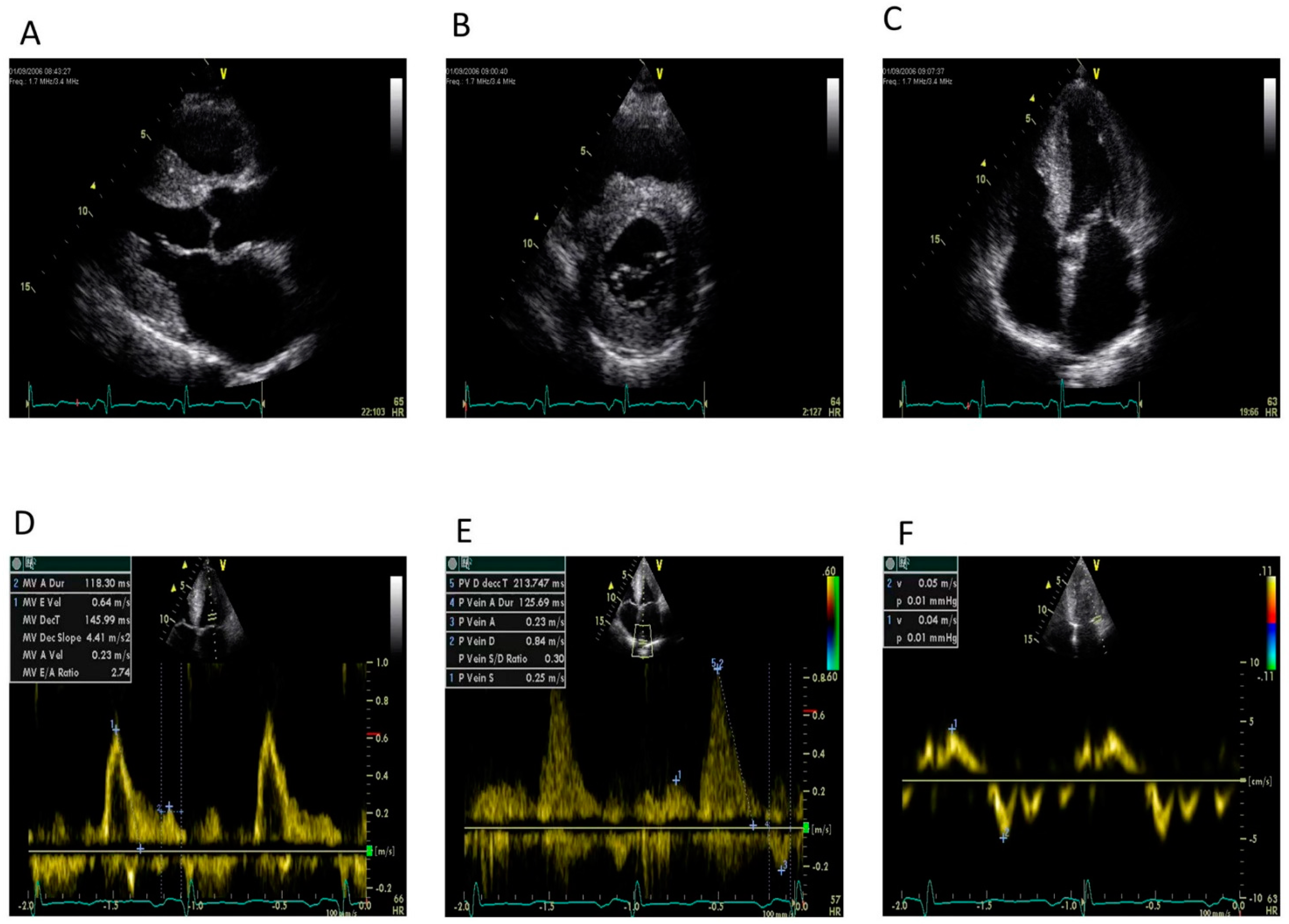Cardiogenetics 11 00012 g003