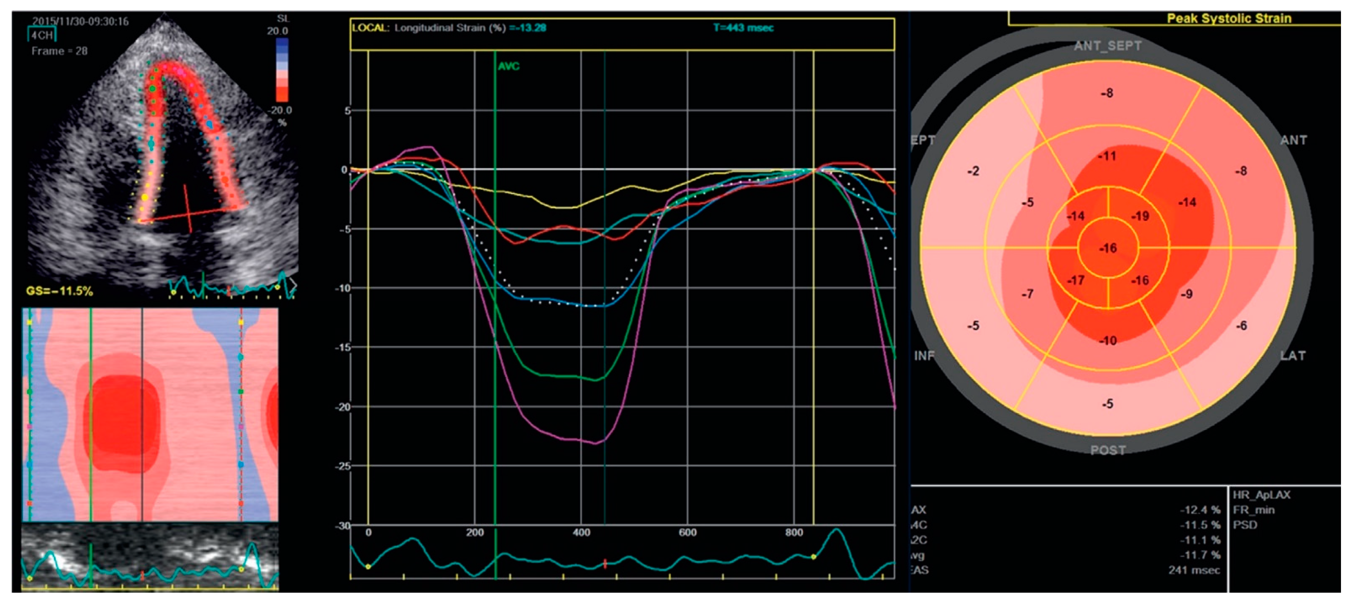 Cardiogenetics 11 00012 g004