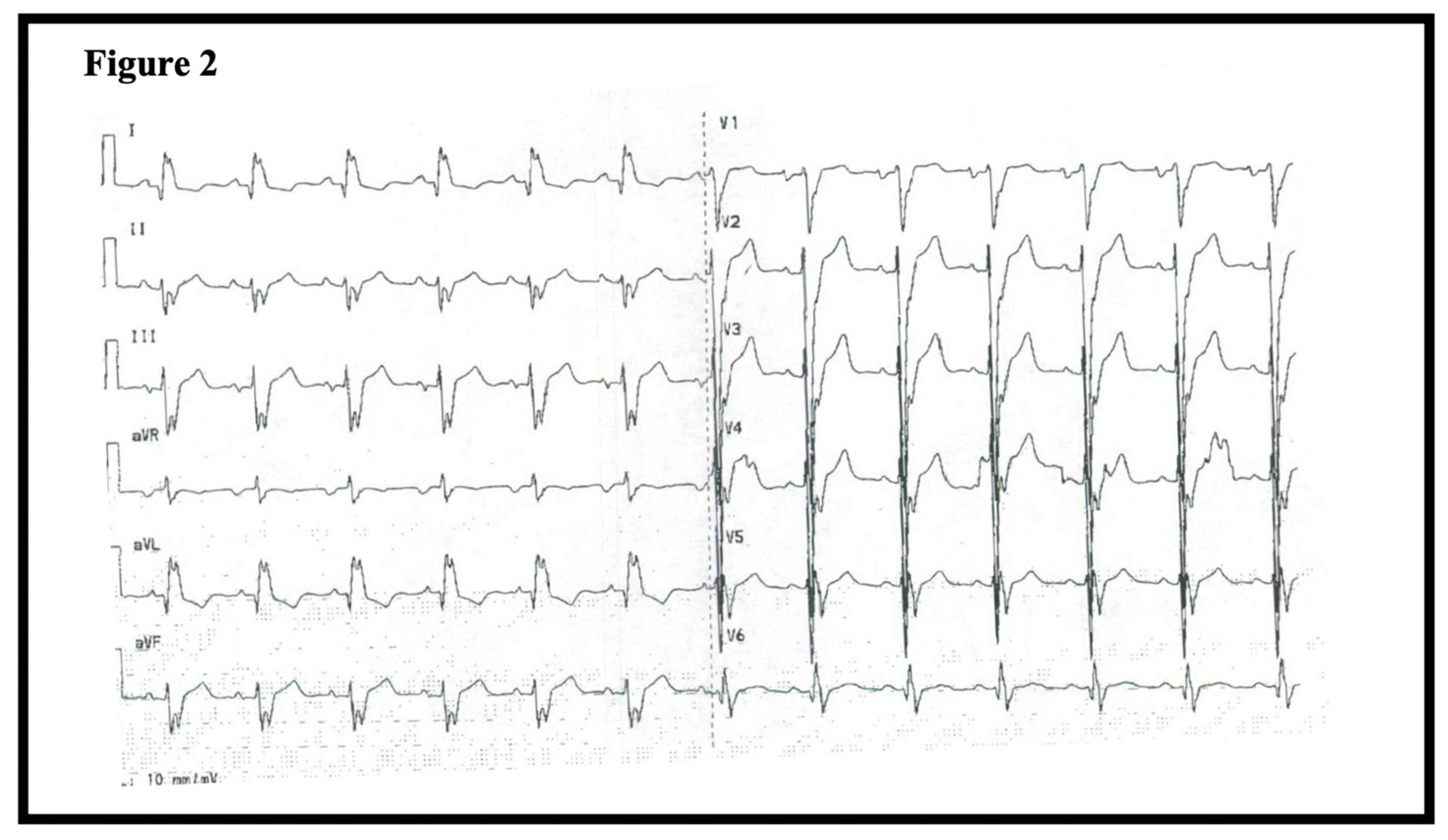 Cardiogenetics 11 00013 g002