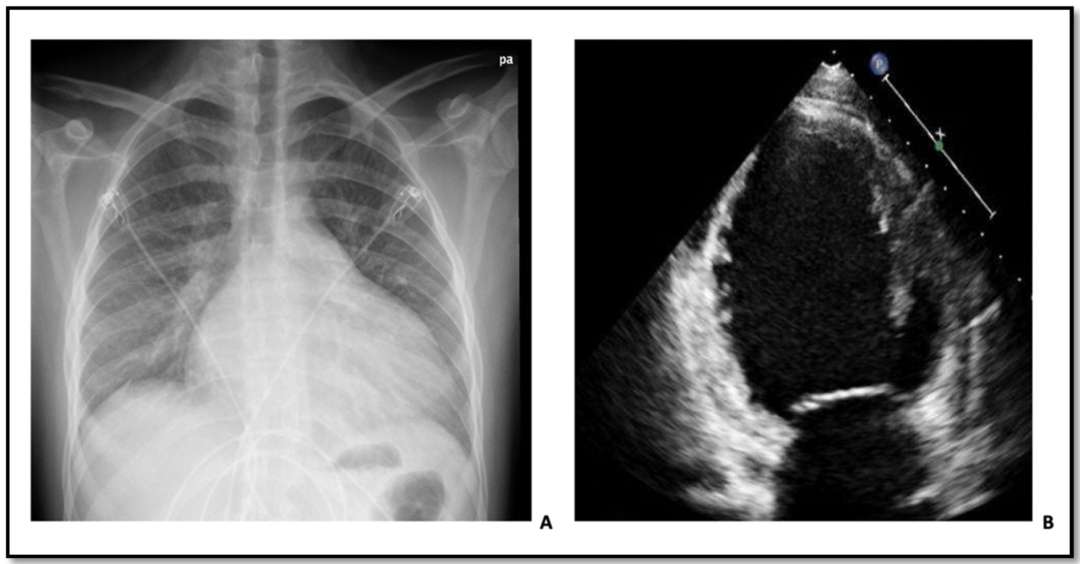 Cardiogenetics 11 00013 g003