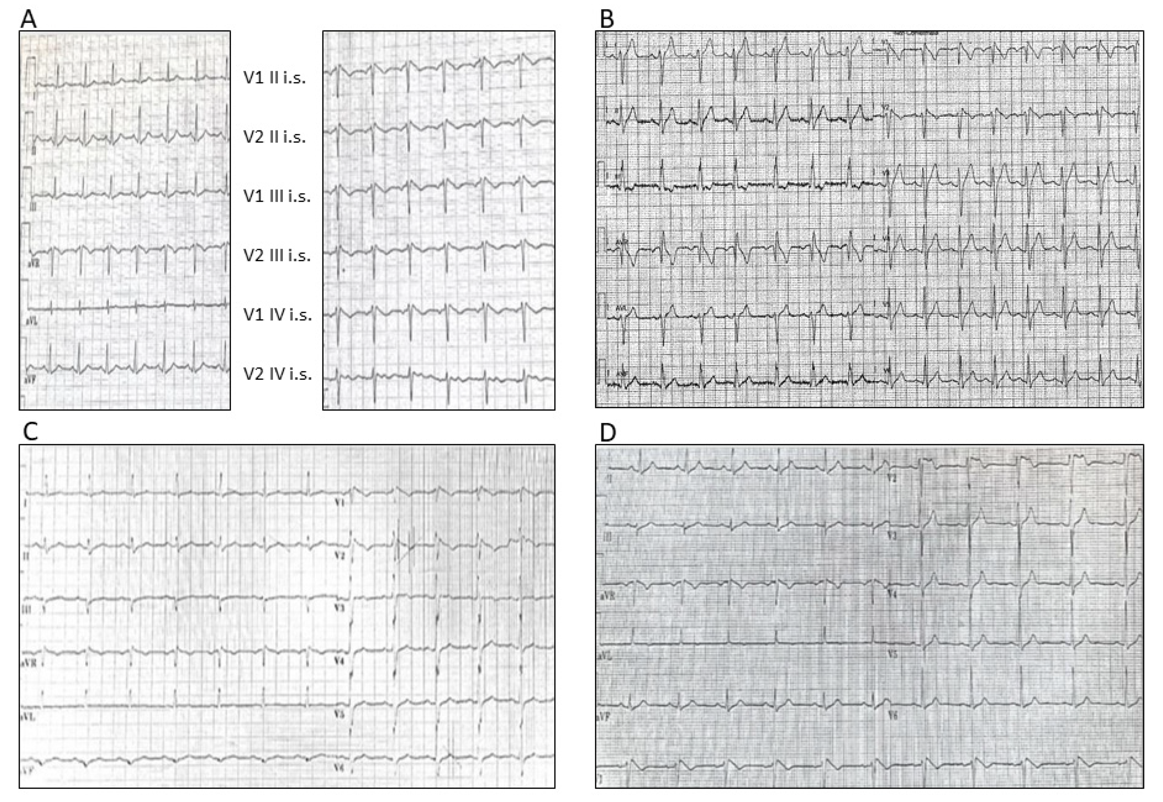 Cardiogenetics 11 00016 g002