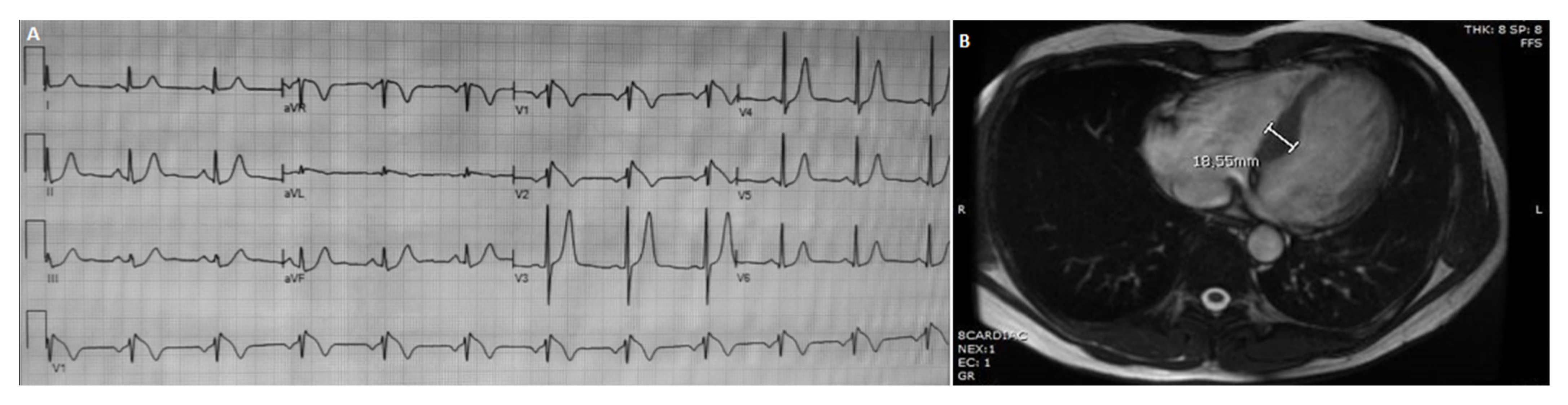 Cardiogenetics 11 00016 g003
