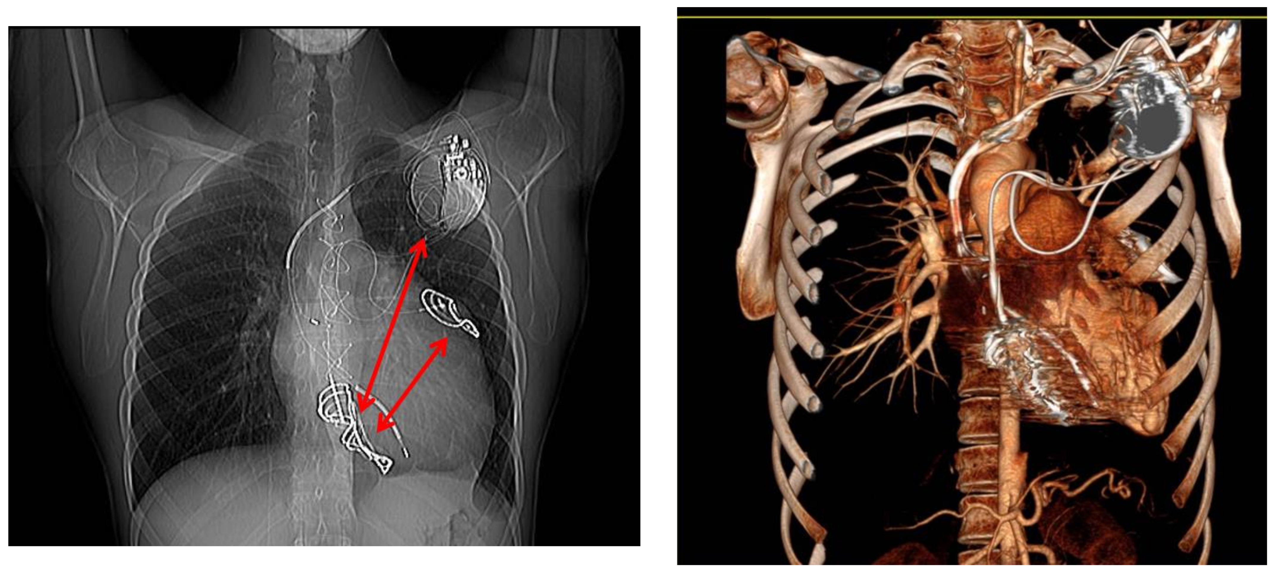 Cardiogenetics 11 00019 g002
