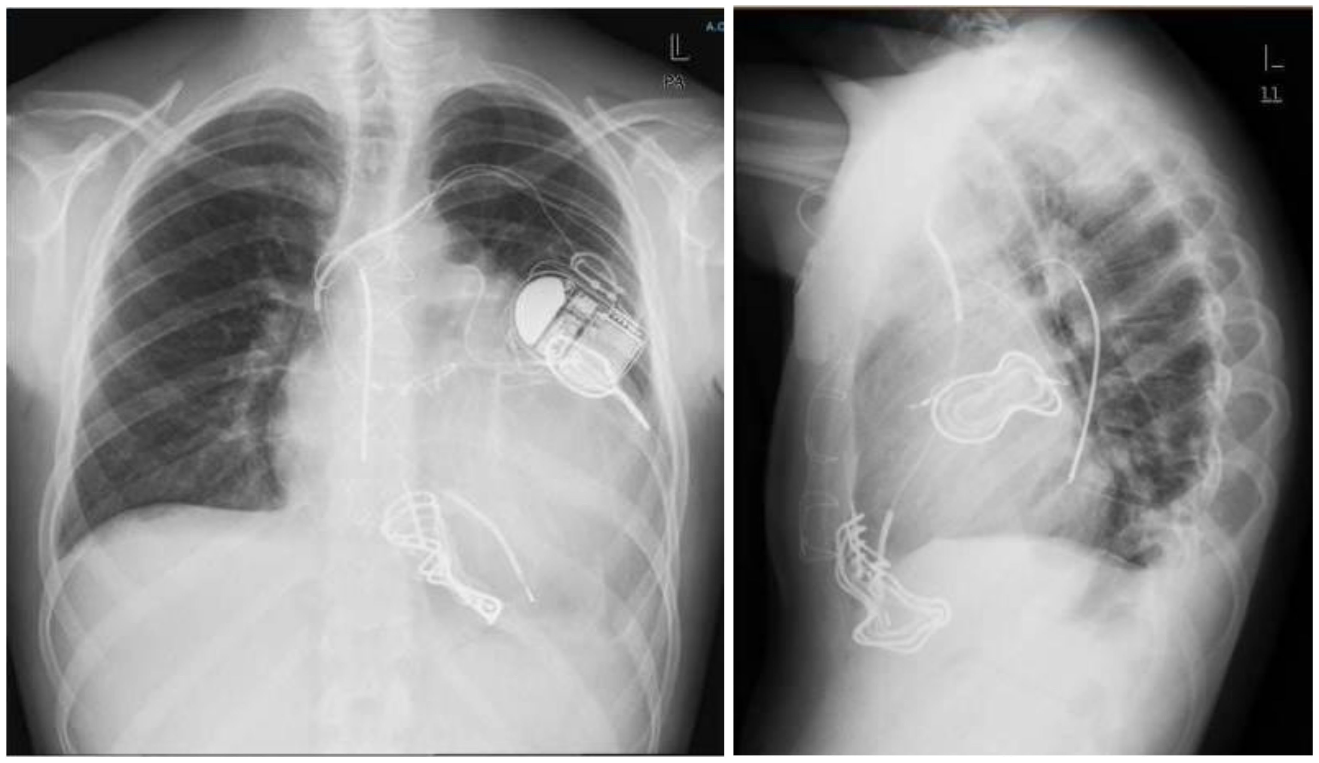 Cardiogenetics 11 00019 g003