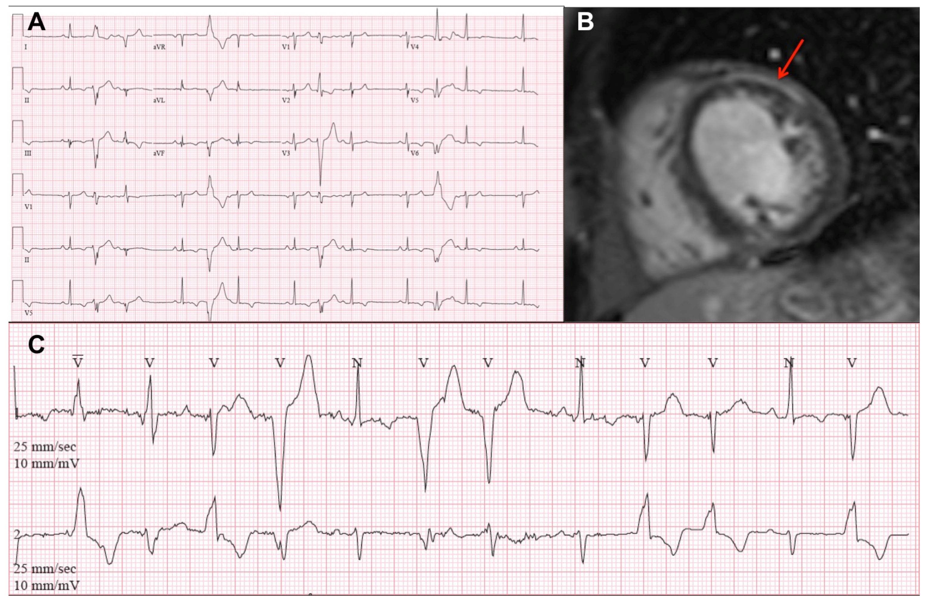 Cardiogenetics 12 00003 g002