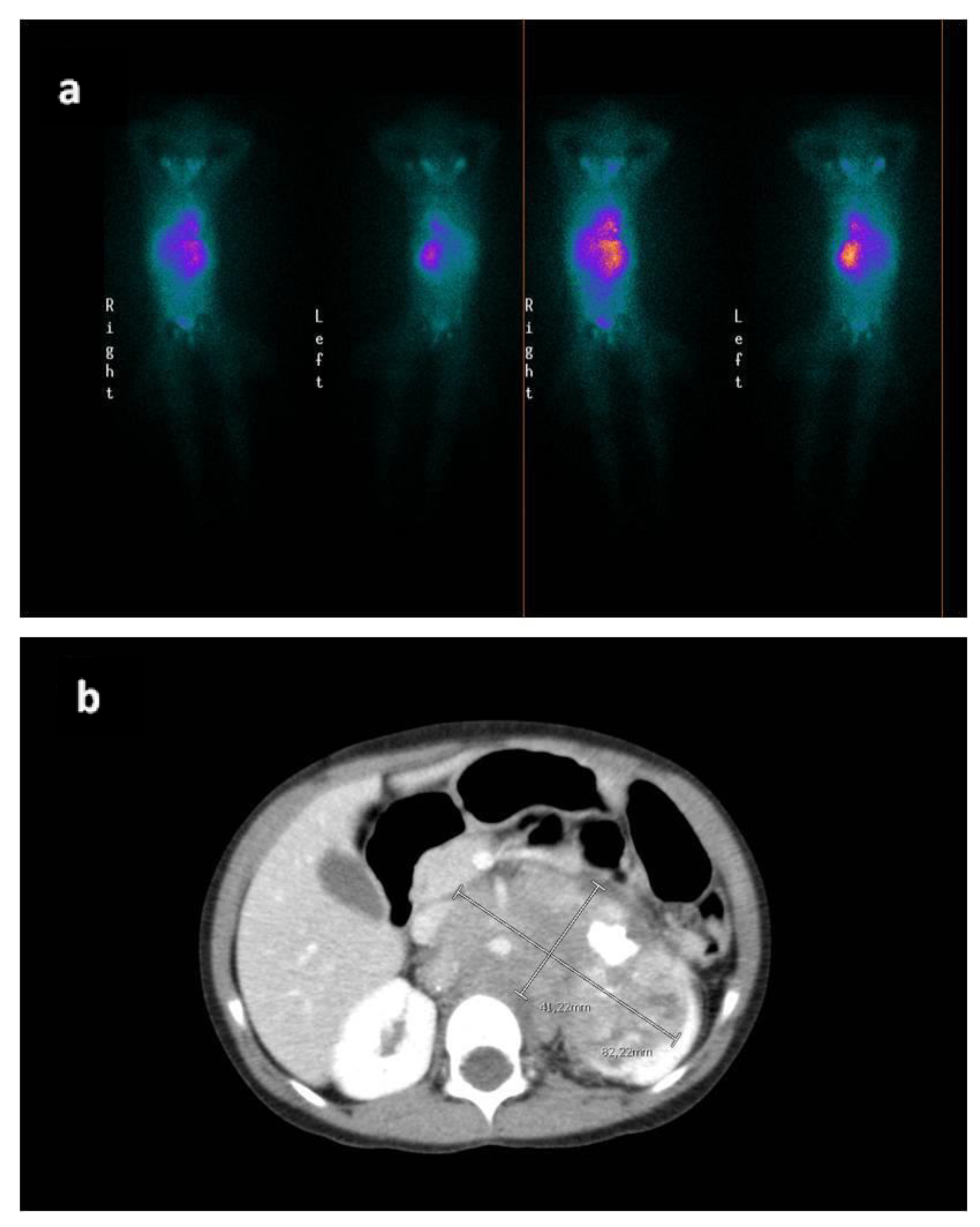 Cardiogenetics 12 00007 g001