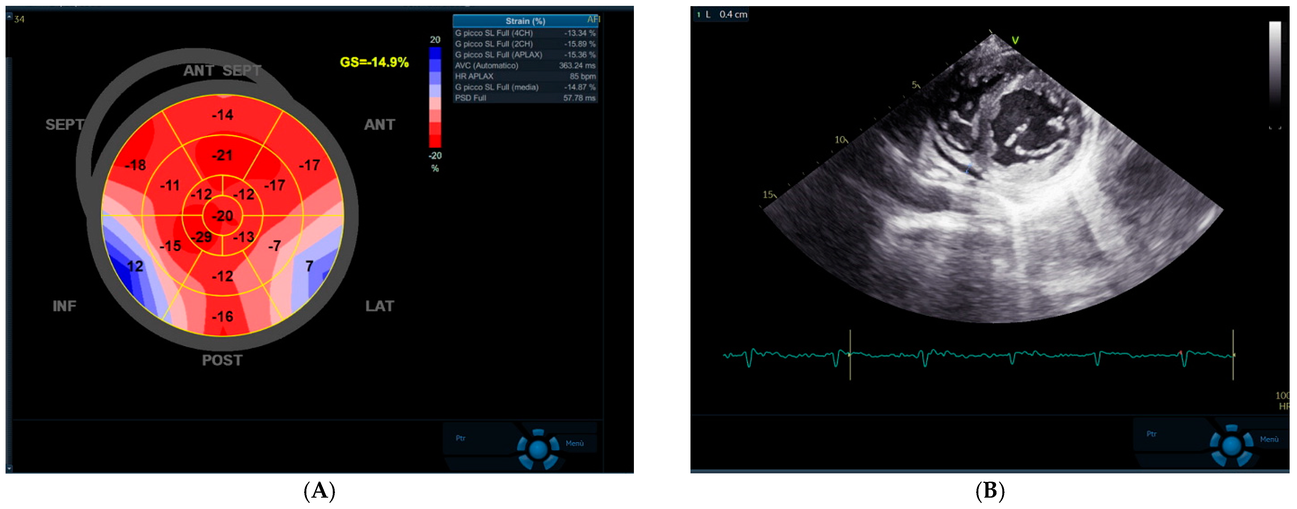 Cardiogenetics 12 00014 g003