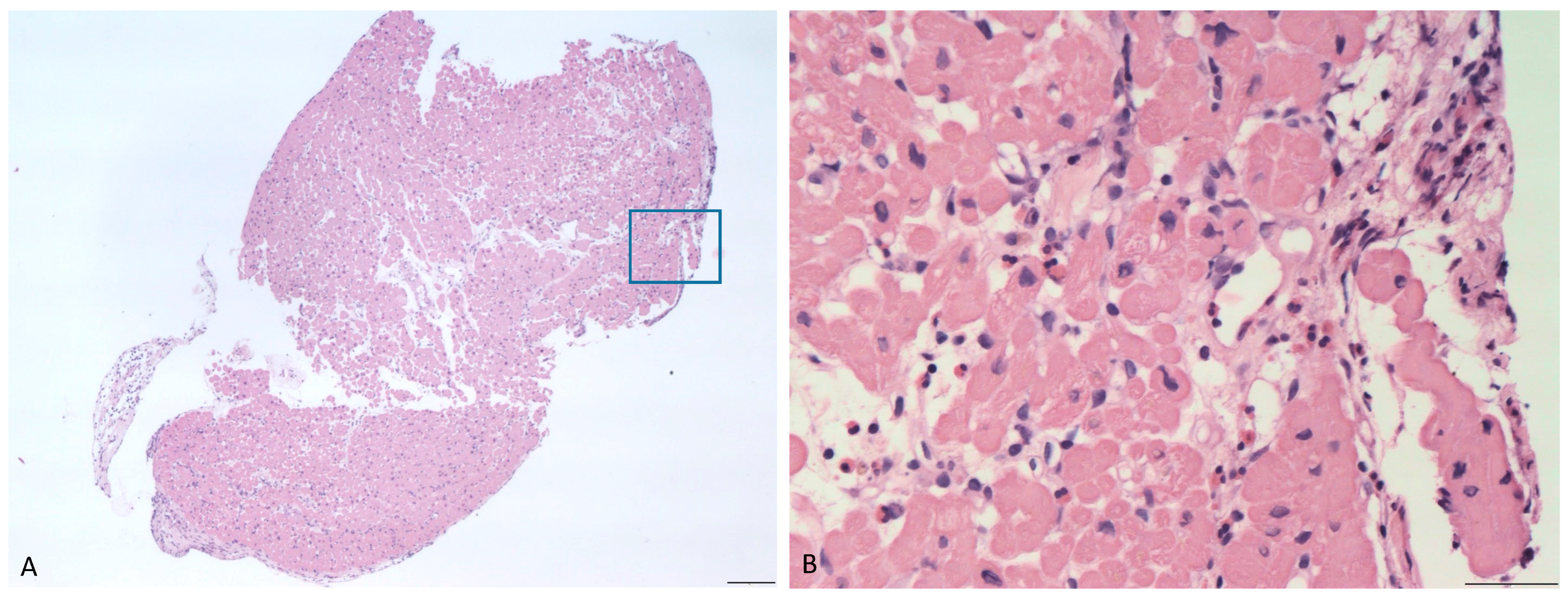 Cardiogenetics 12 00014 g004