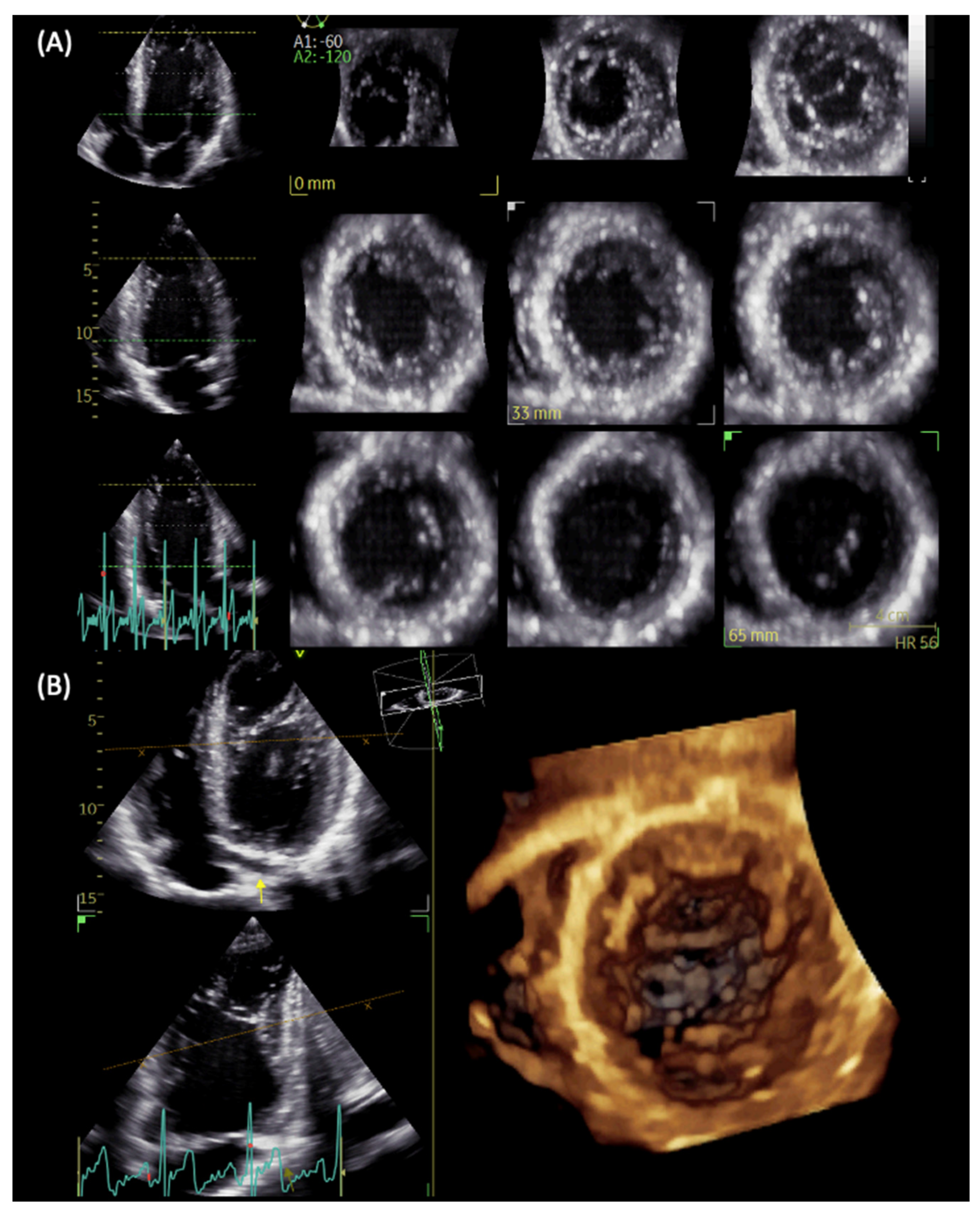 Cardiogenetics 12 00016 g003 Cardiogenetics 12 00016 g003