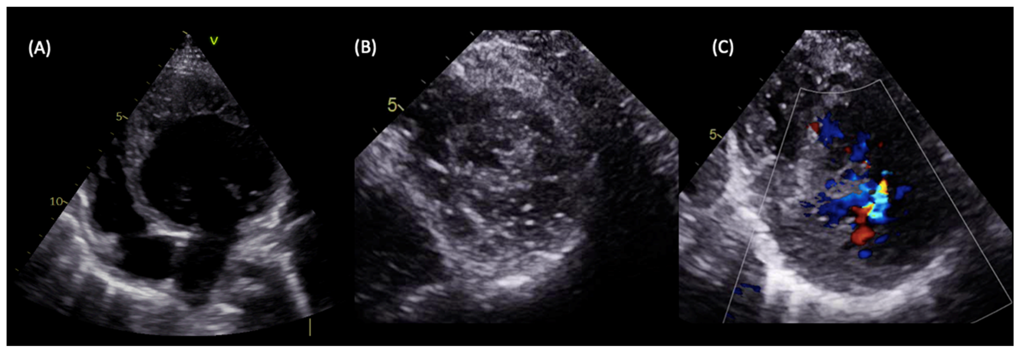 Cardiogenetics 12 00016 g004 Cardiogenetics 12 00016 g004