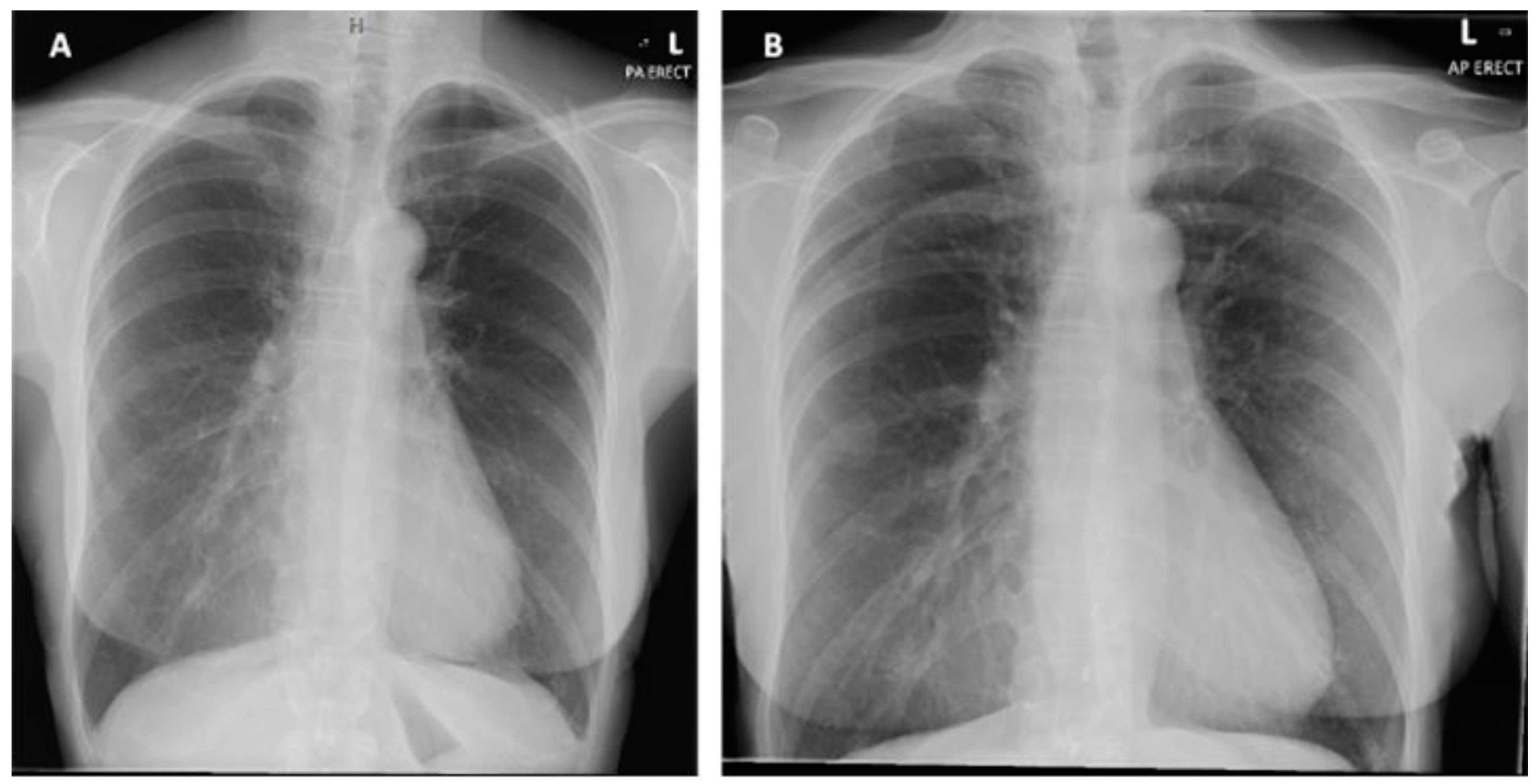 Cardiogenetics 12 00023 g002