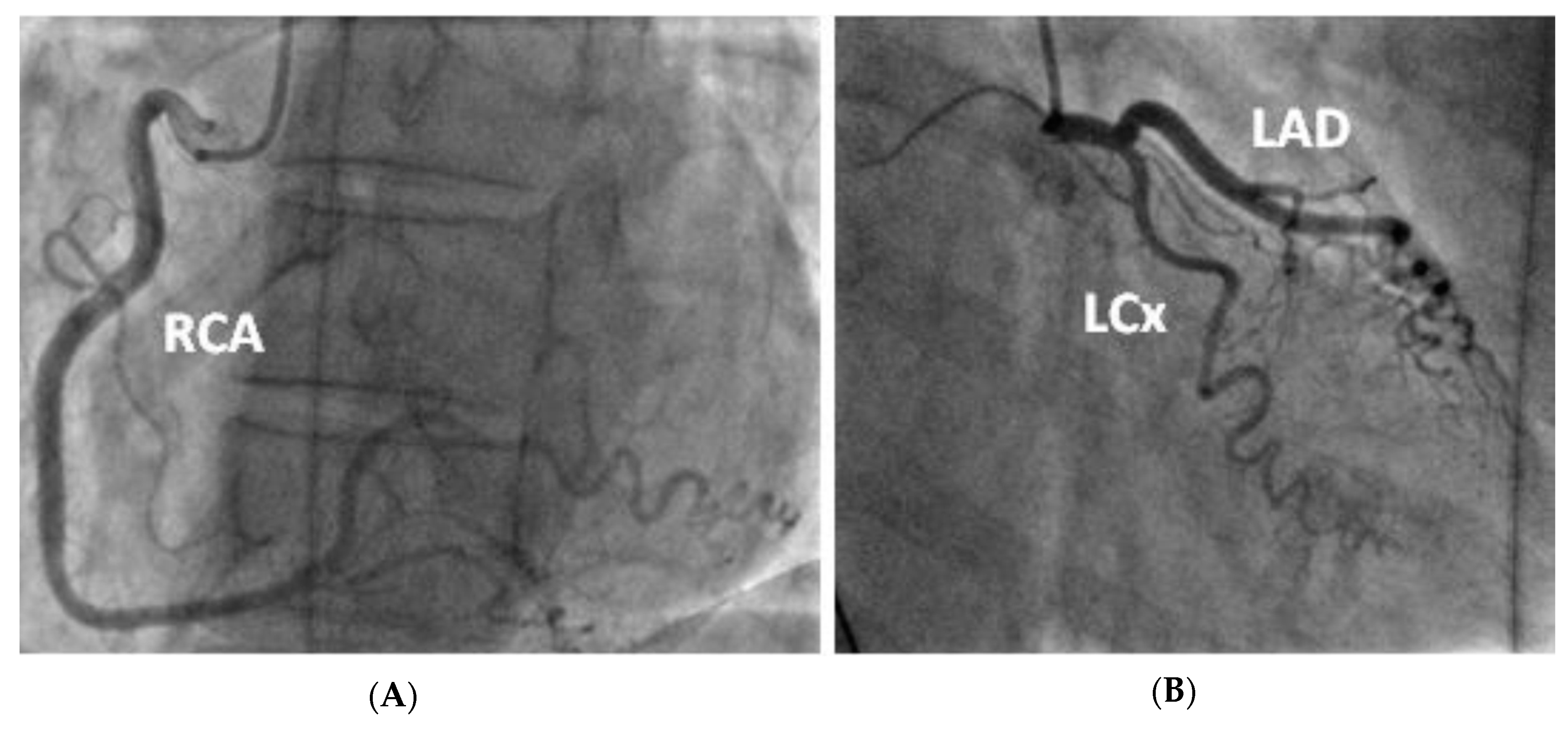 Cardiogenetics 12 00023 g003