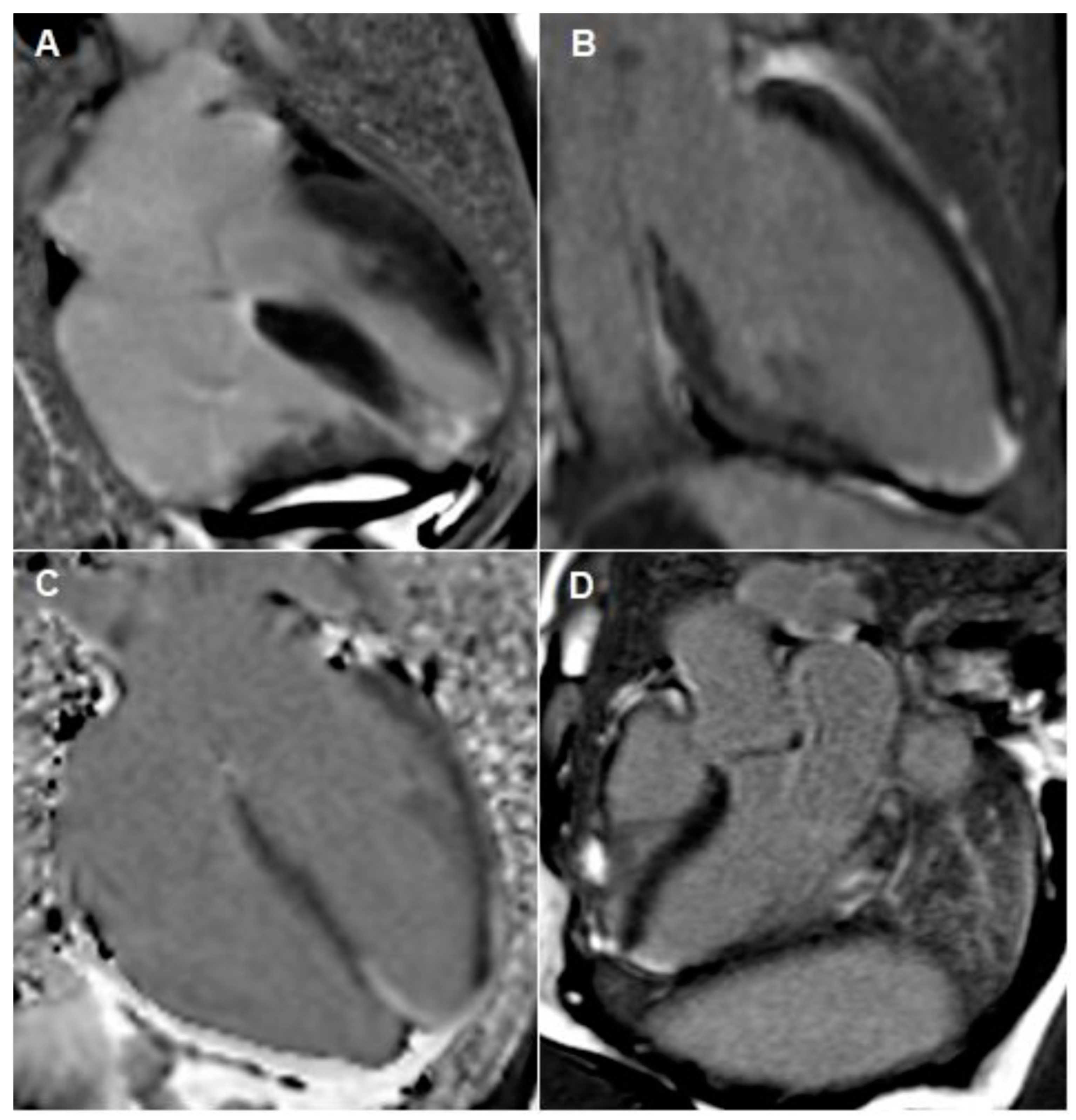 Cardiogenetics 12 00023 g004
