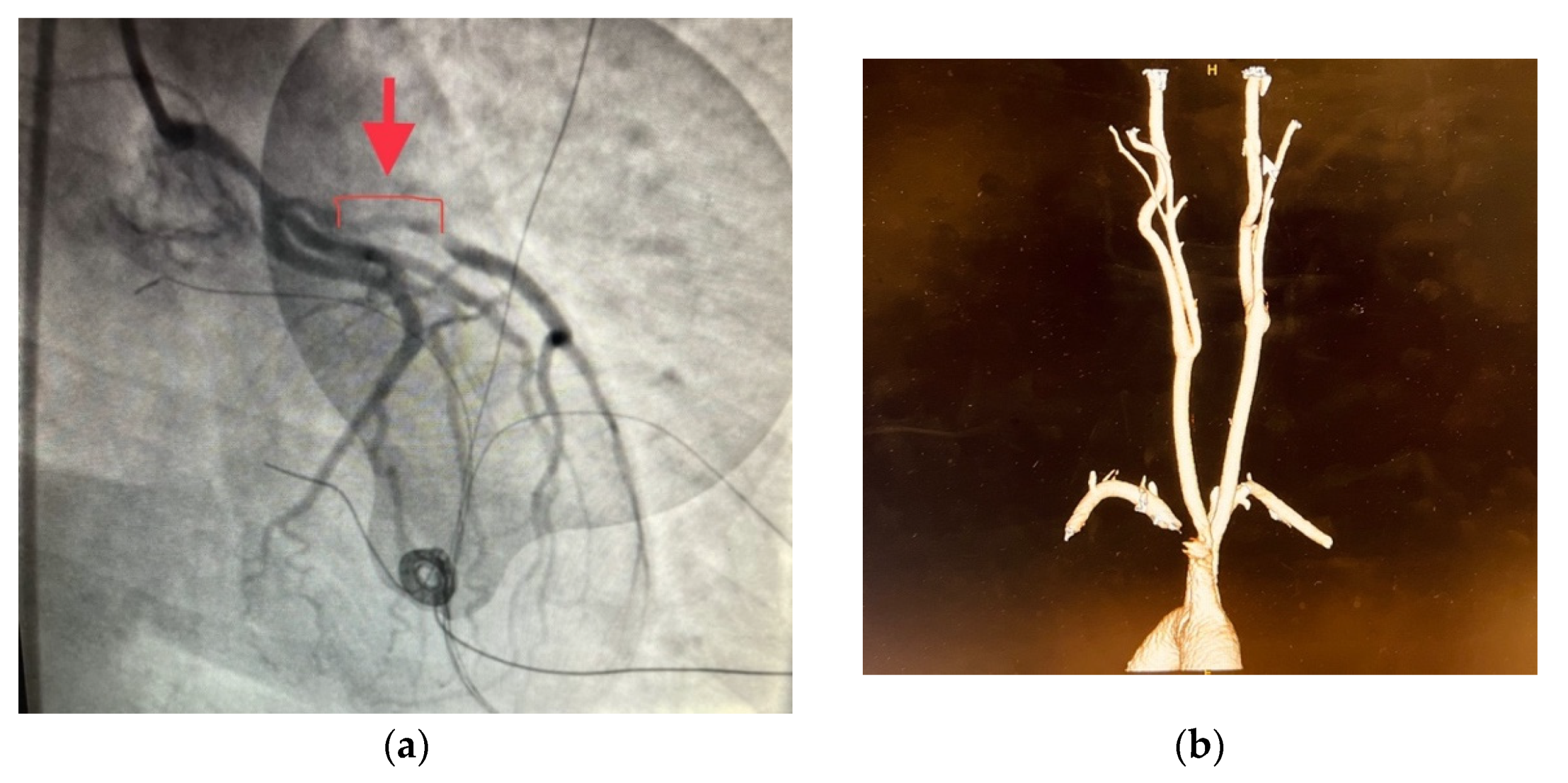 Cardiogenetics 12 00026 g001a Cardiogenetics 12 00026 g001a