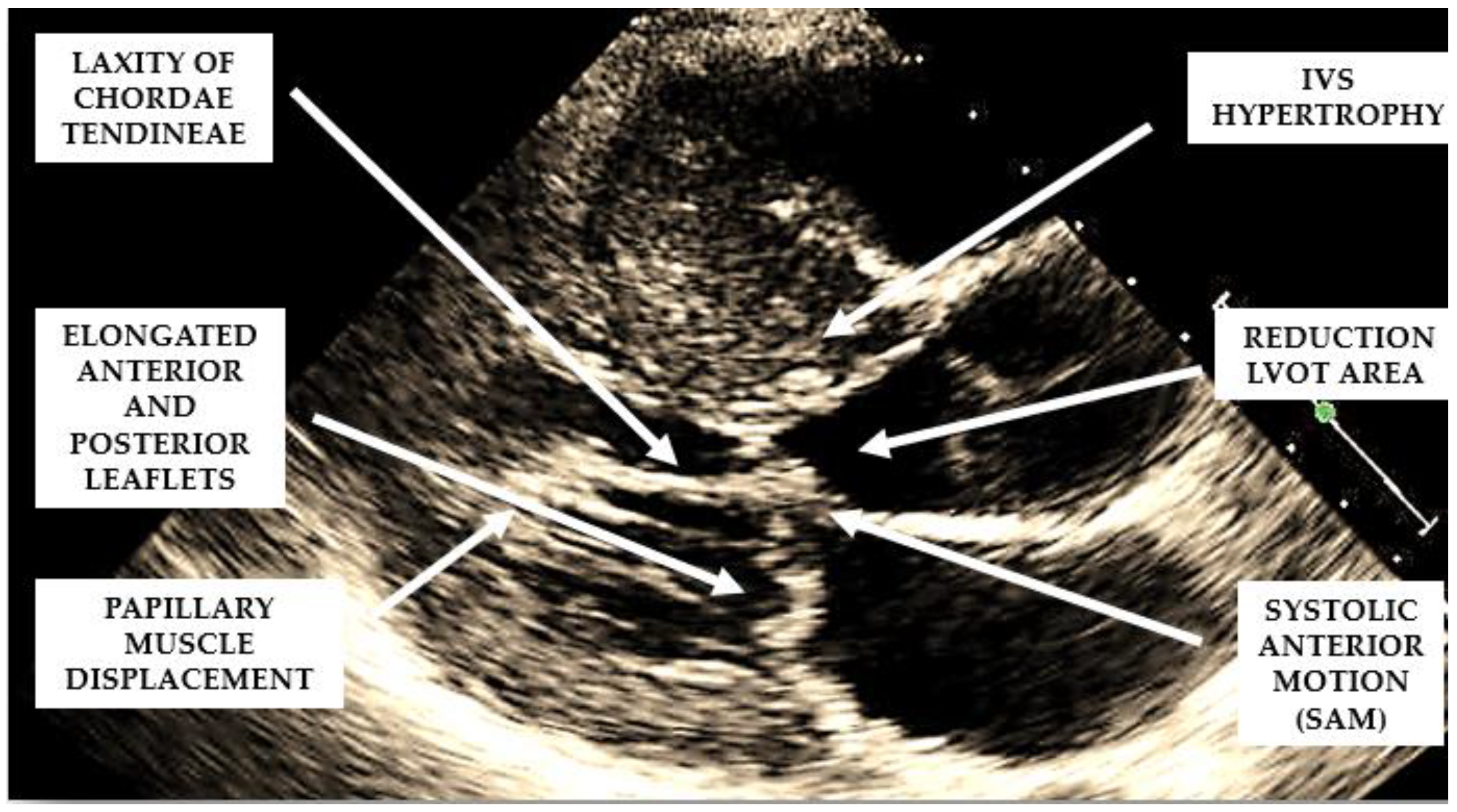 Cardiogenetics 13 00008 g002 Cardiogenetics 13 00008 g002