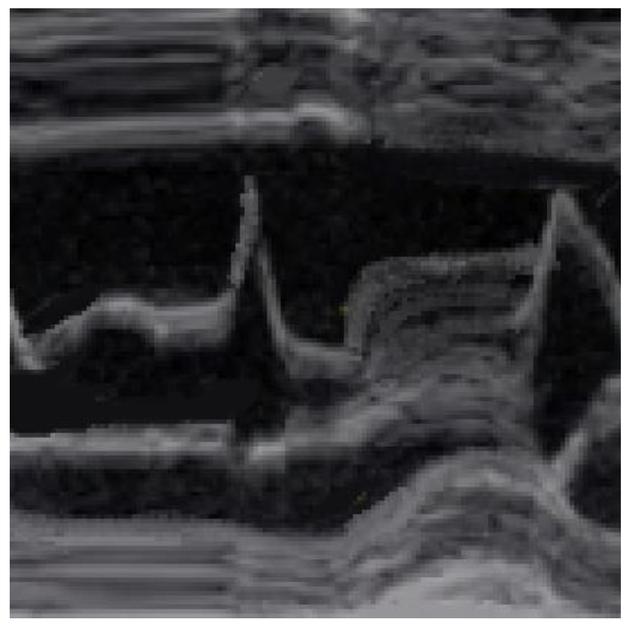 Cardiogenetics 13 00008 g003 Cardiogenetics 13 00008 g003