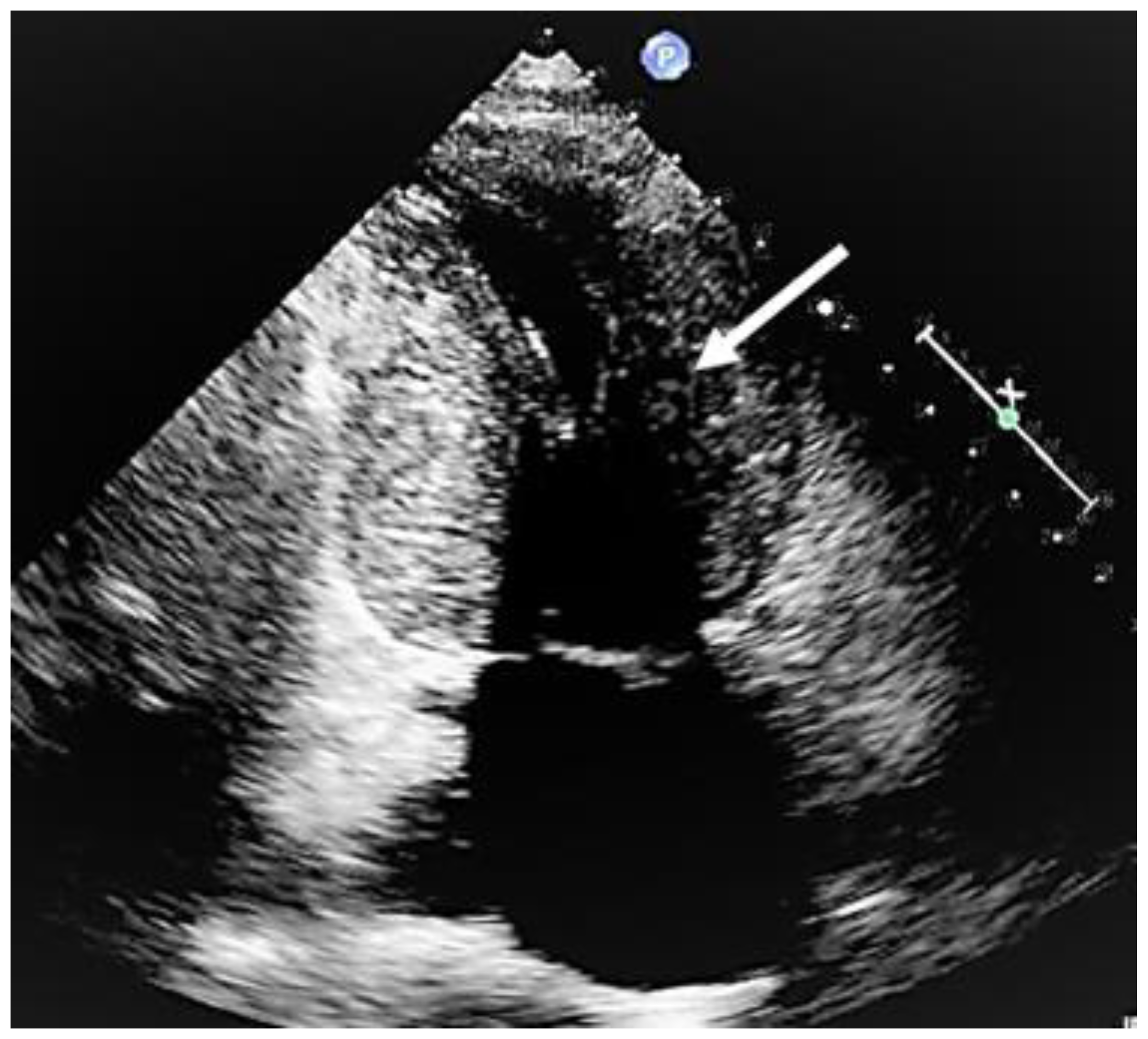 Cardiogenetics 13 00008 g005 Cardiogenetics 13 00008 g005
