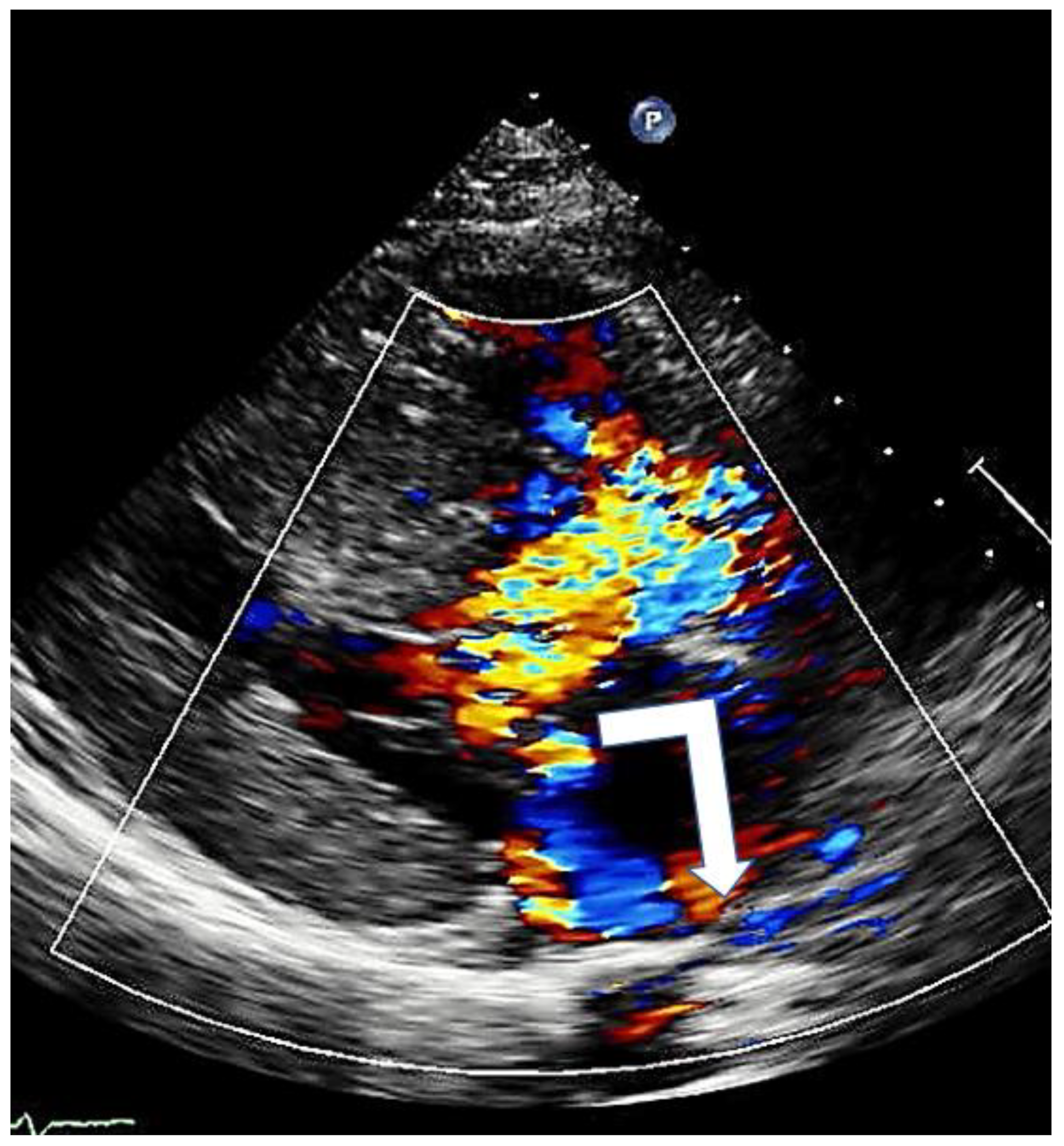 Cardiogenetics 13 00008 g006 Cardiogenetics 13 00008 g006