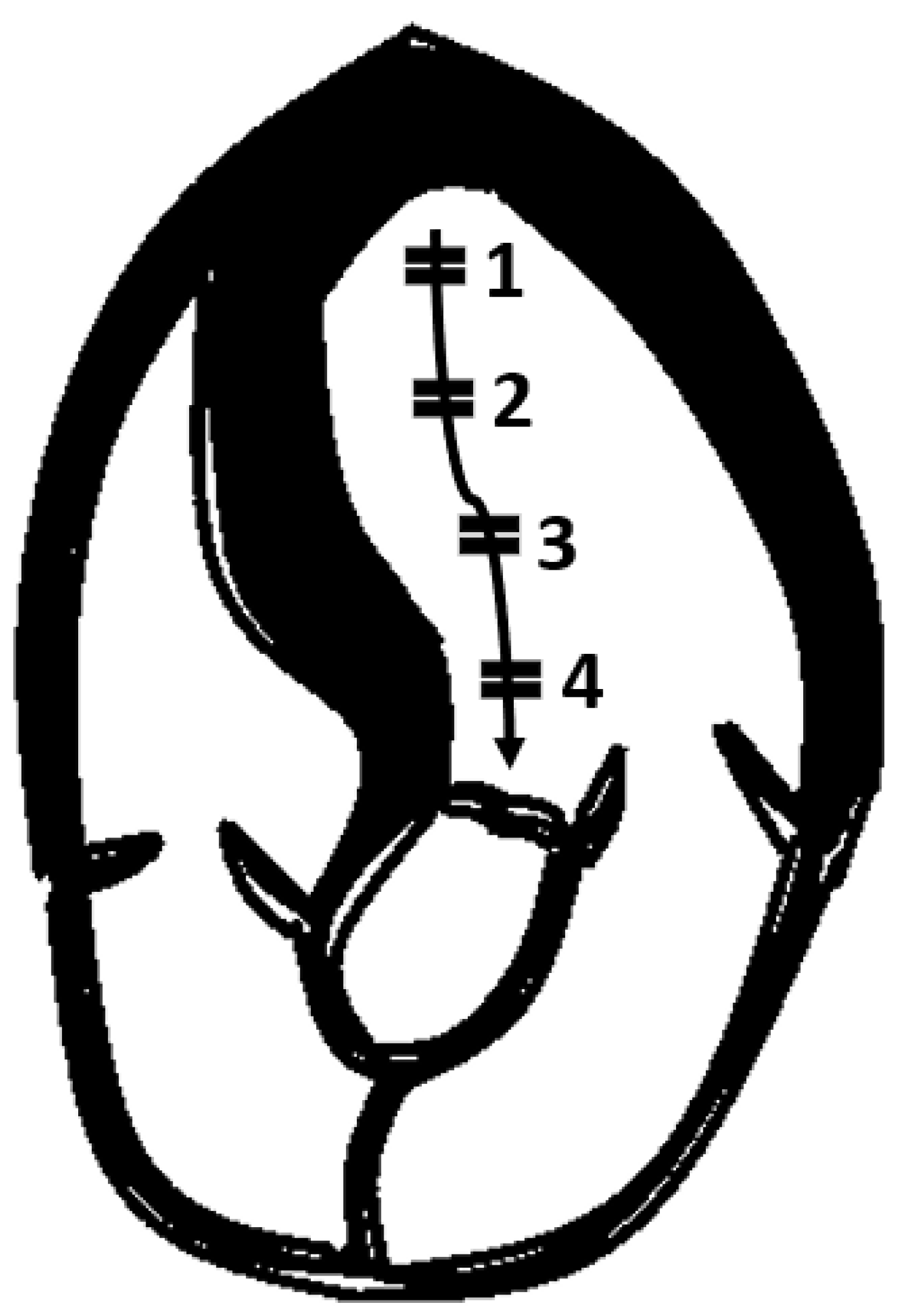 Cardiogenetics 13 00008 g007 Cardiogenetics 13 00008 g007