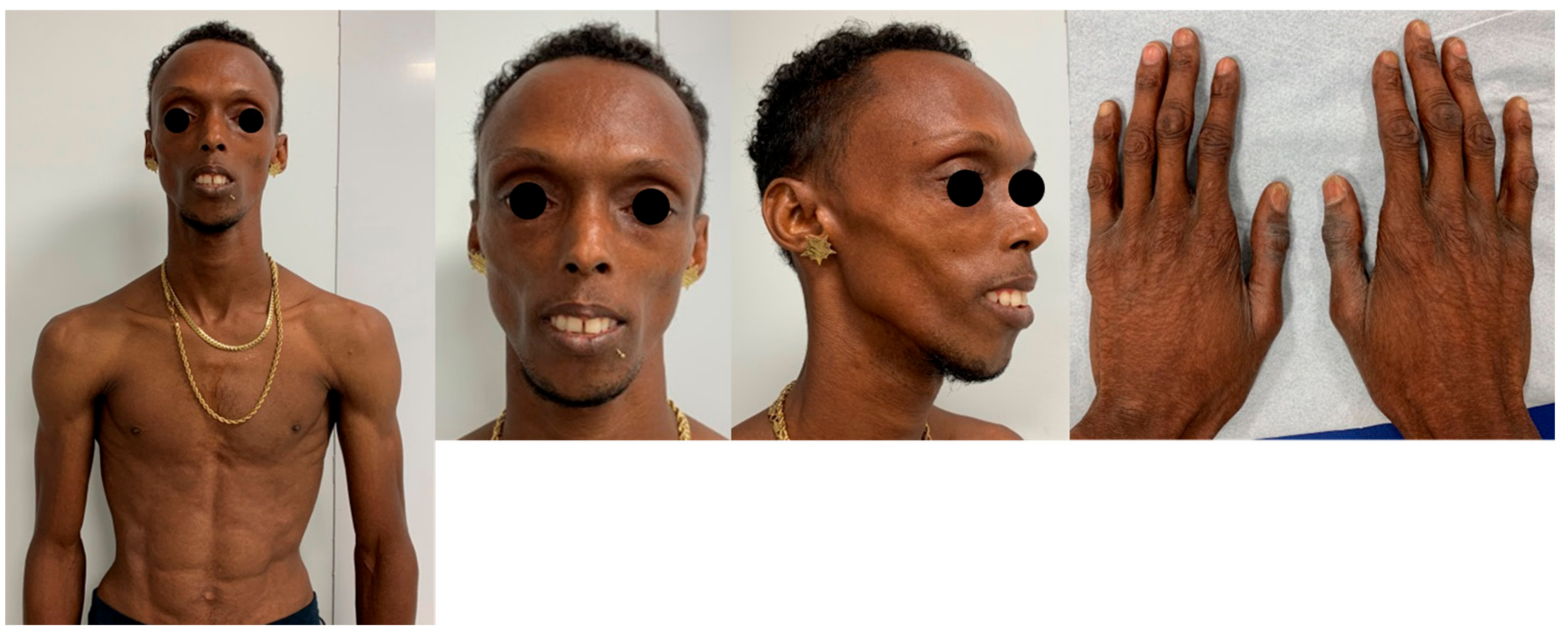 Cardiogenetics 13 00013 g003