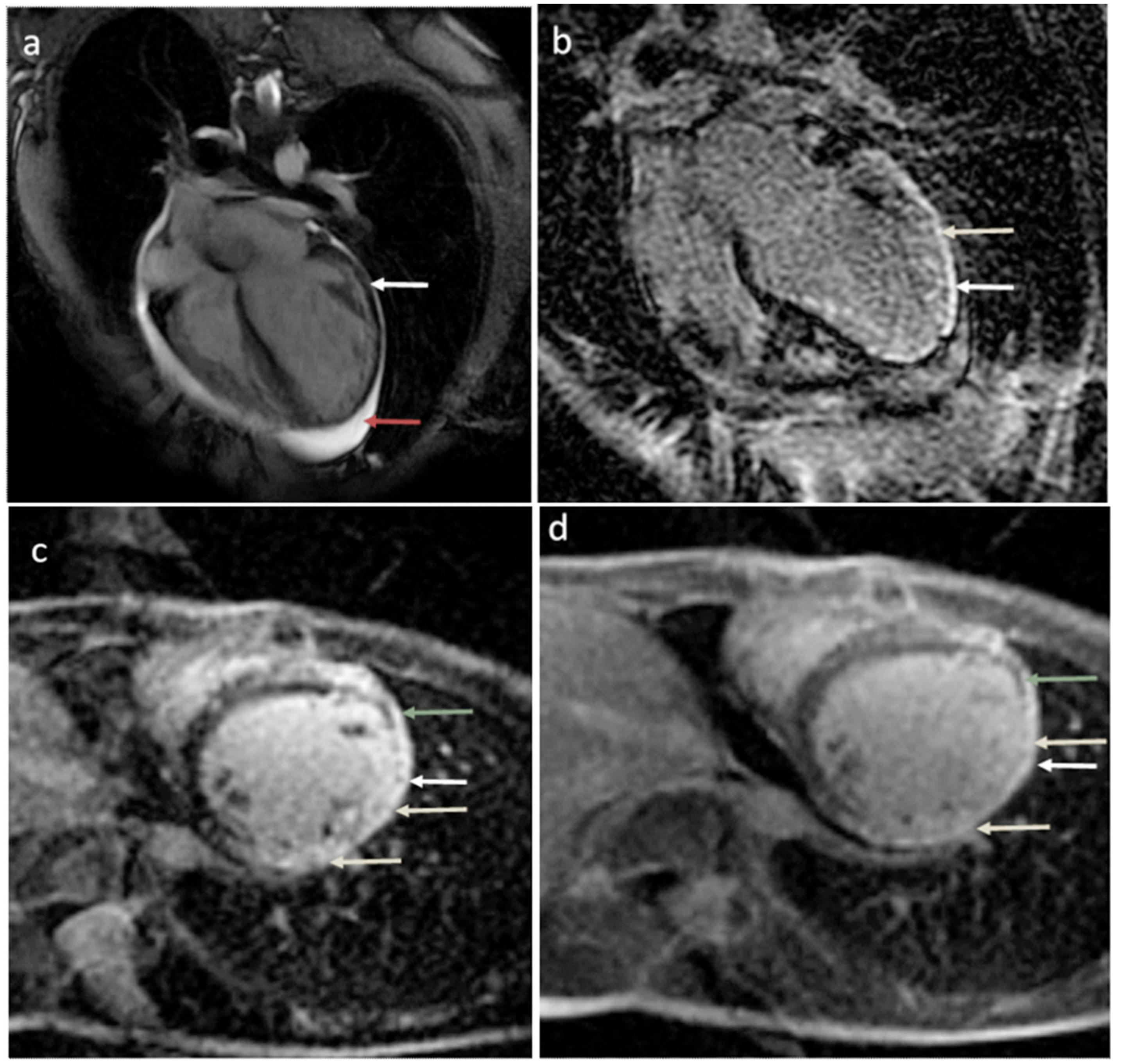 Cardiogenetics 13 00013 g004