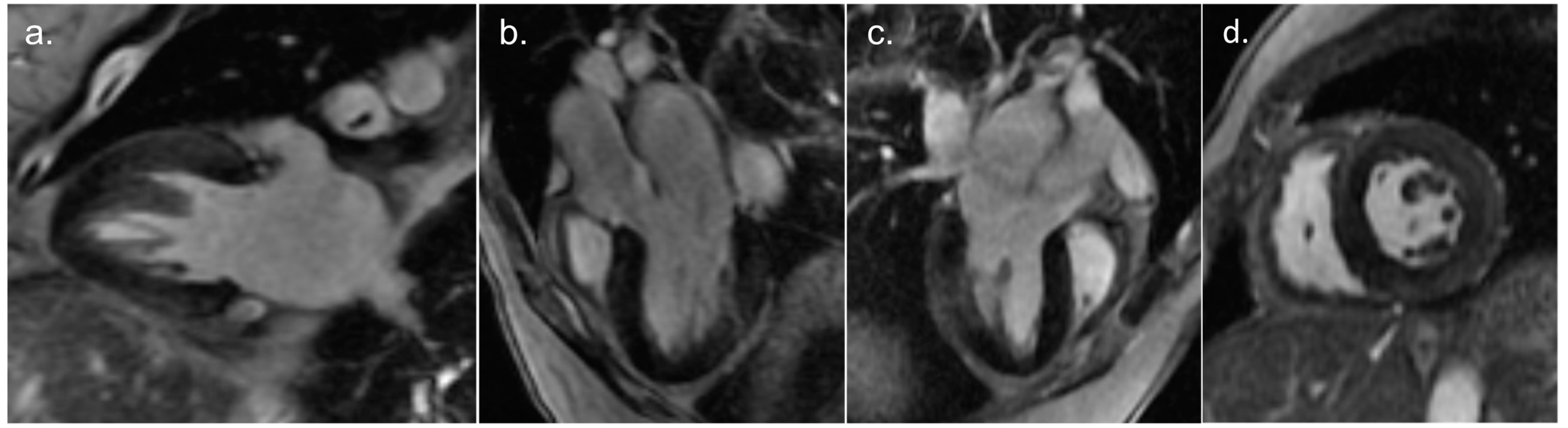 Cardiogenetics 13 00014 g003