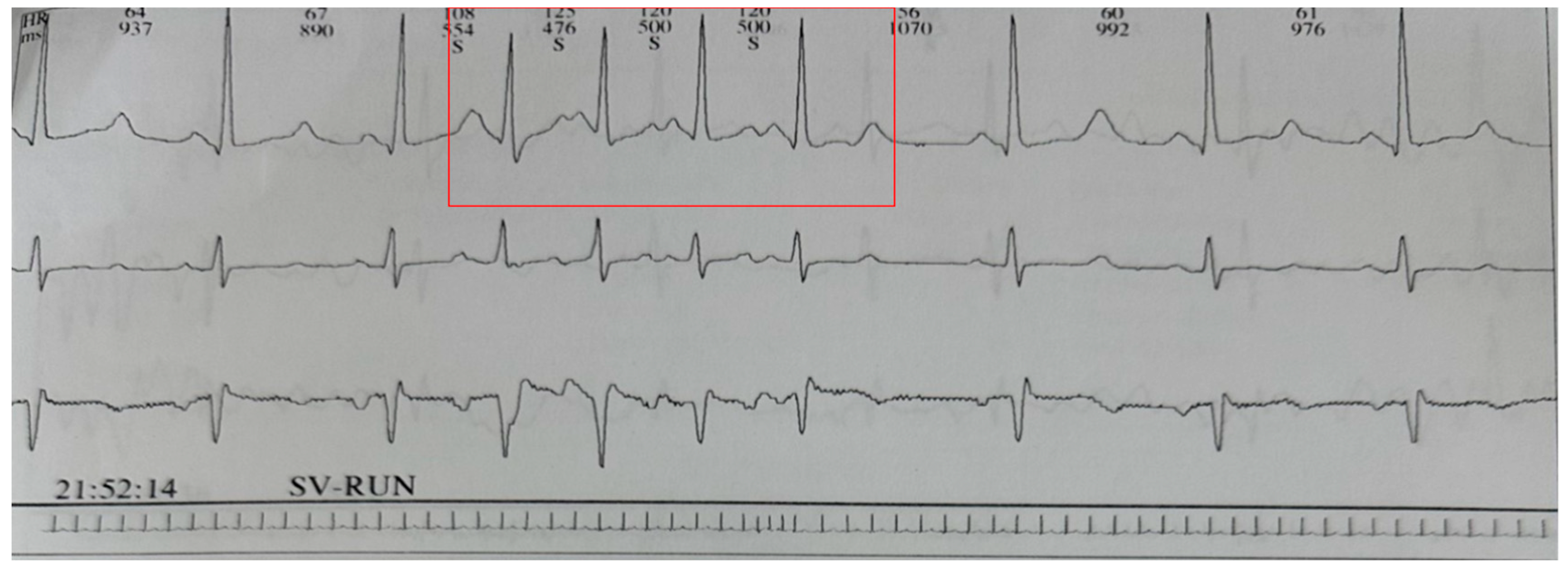 Cardiogenetics 14 00003 g001