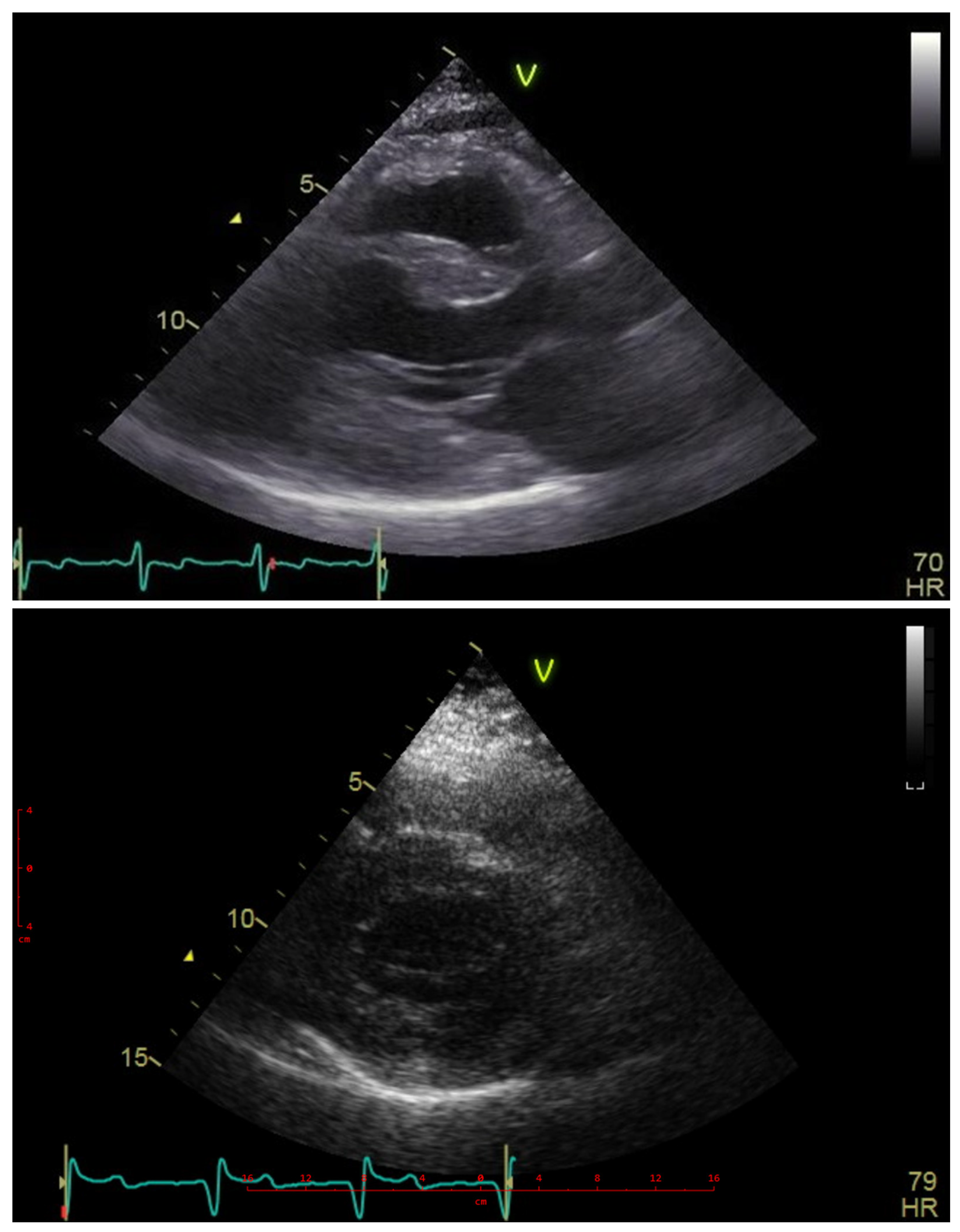 Cardiogenetics 14 00006 g003
