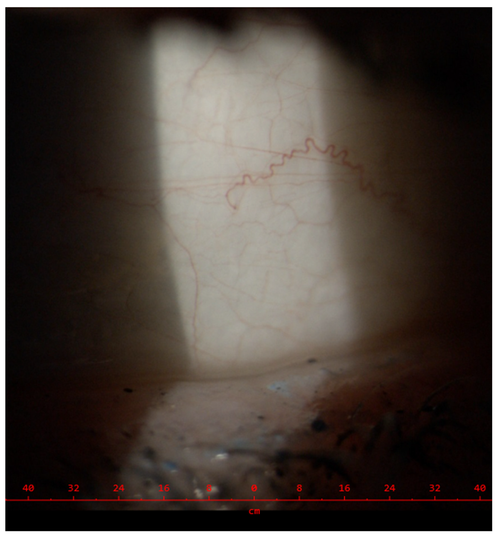 Cardiogenetics 14 00006 g005