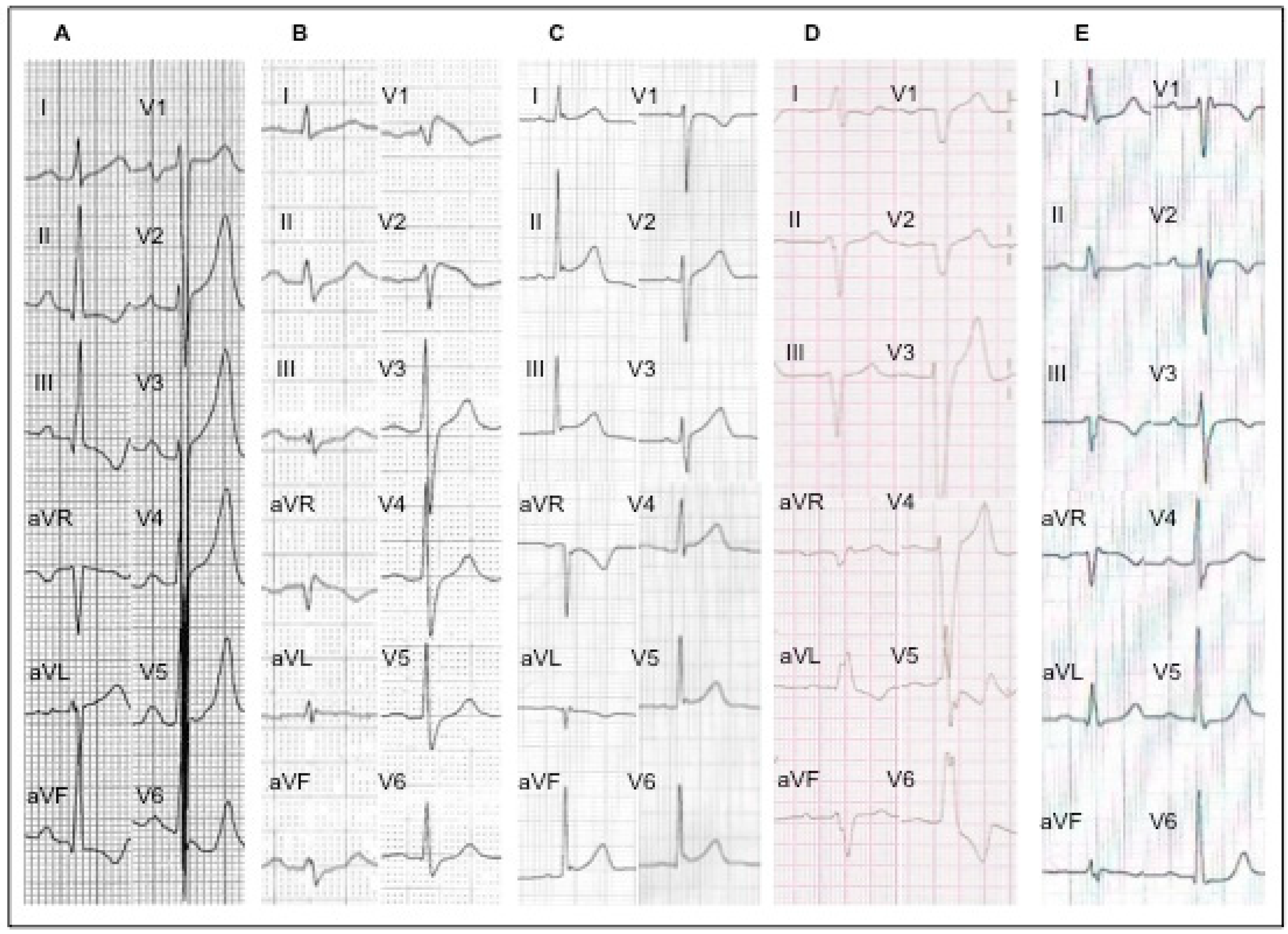 Cardiogenetics 15 00005 g003