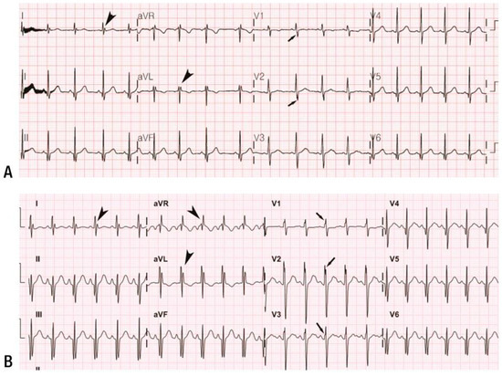 Cardiogenetics 15 00007 g002