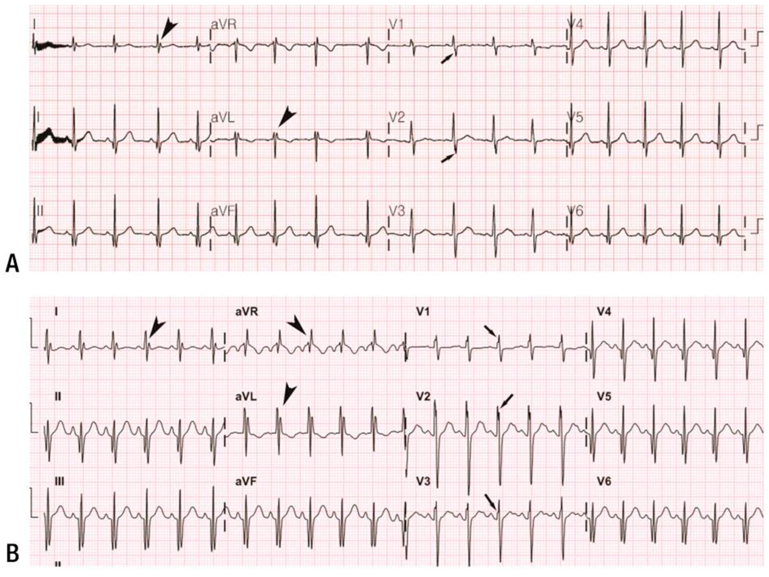 Cardiogenetics 15 00007 g002