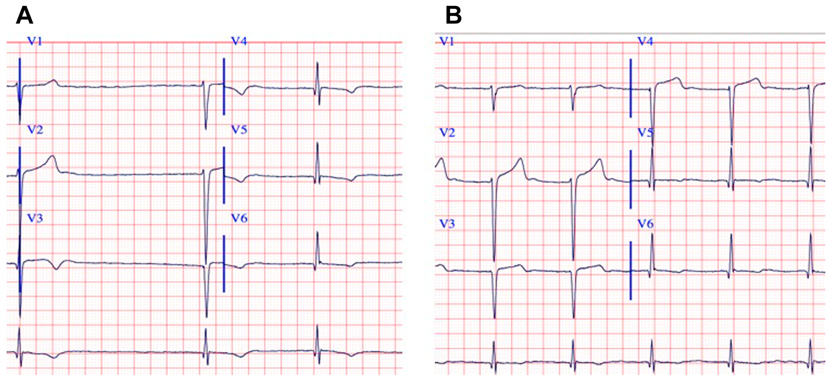 Cardiogenetics 15 00007 g005