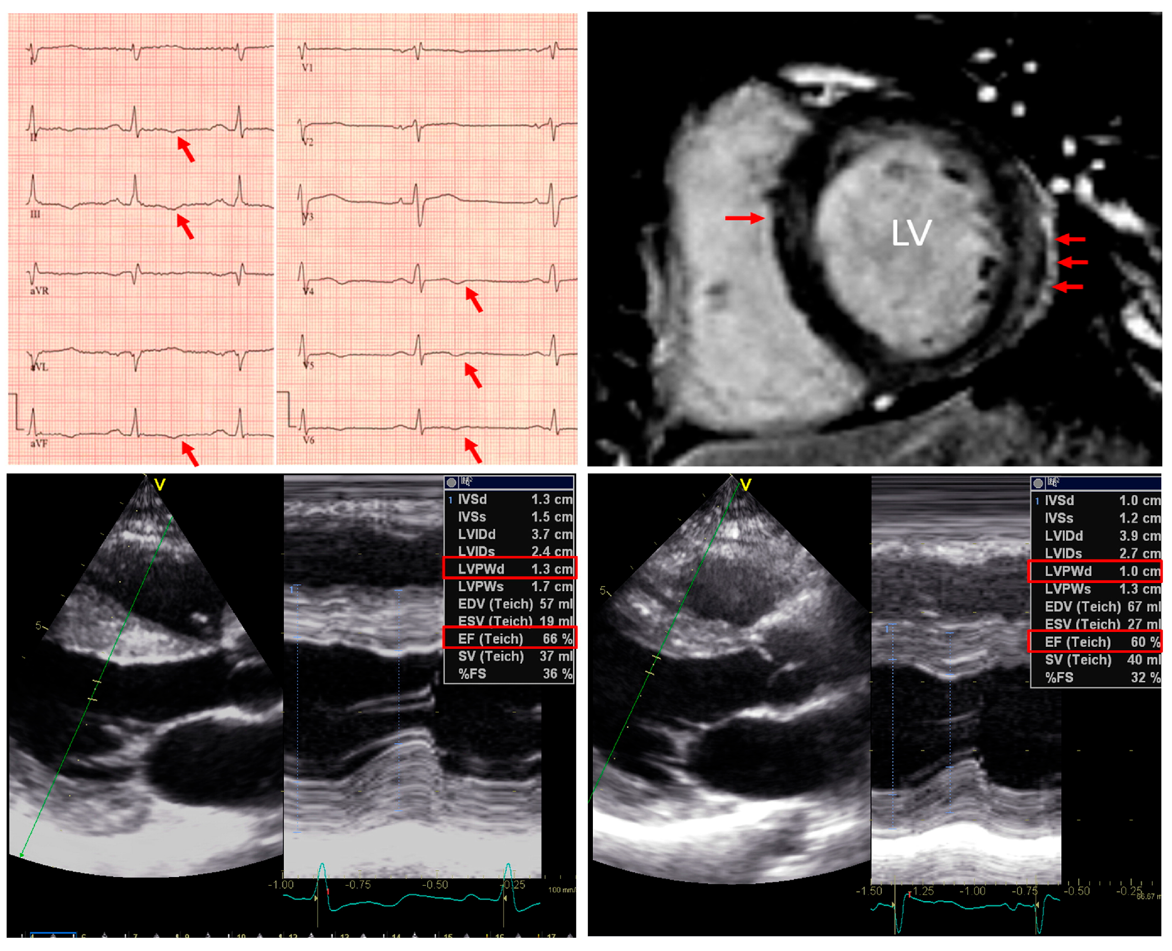 Cardiogenetics 15 00007 g006