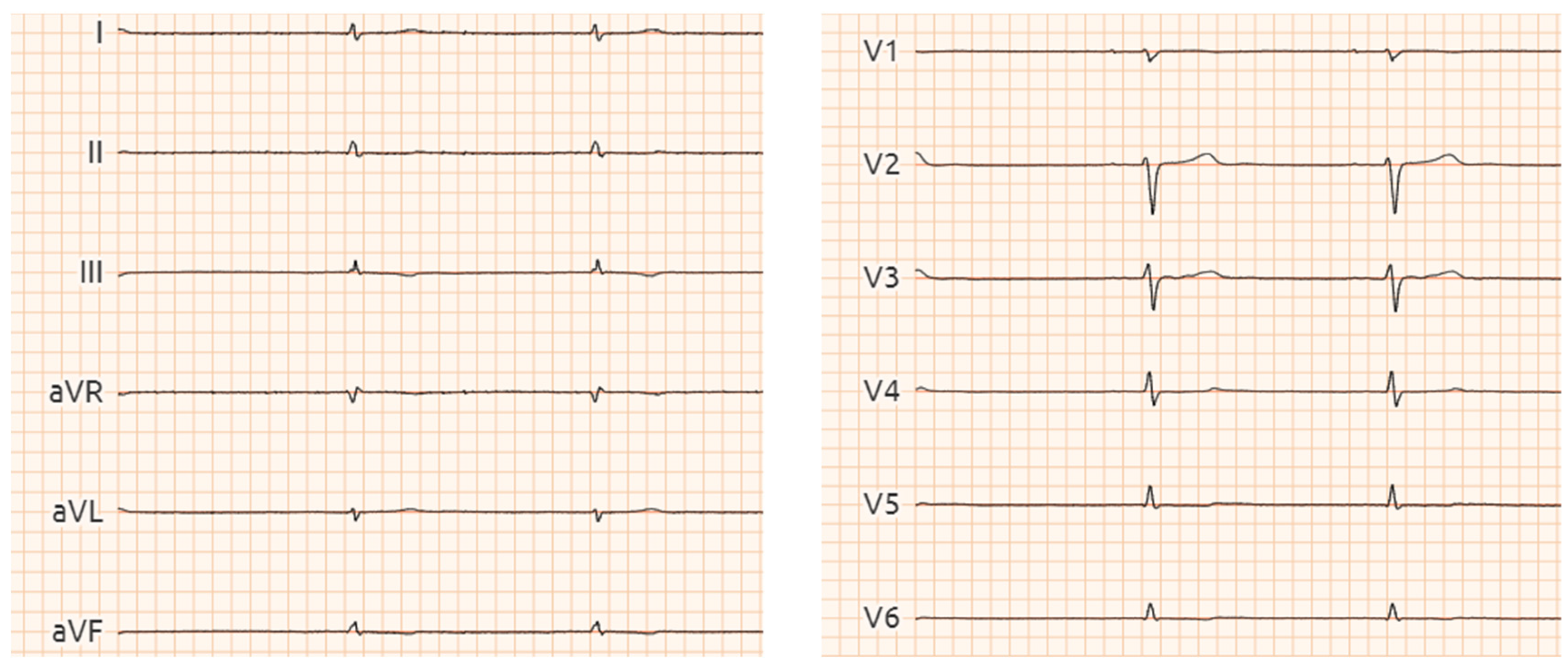 Cardiogenetics 15 00013 g005