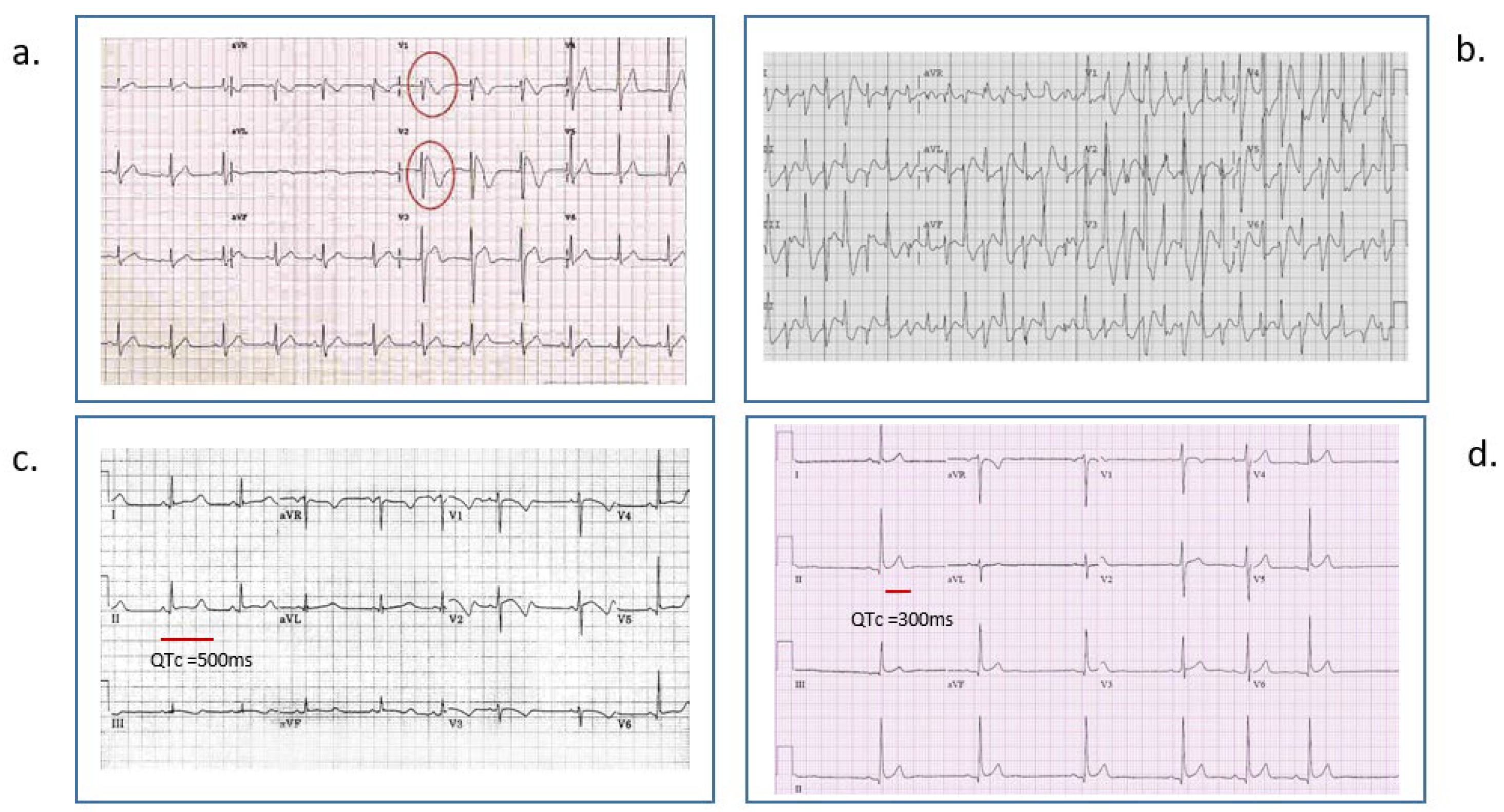 Cardiogenetics 15 00025 g002 Cardiogenetics 15 00025 g002
