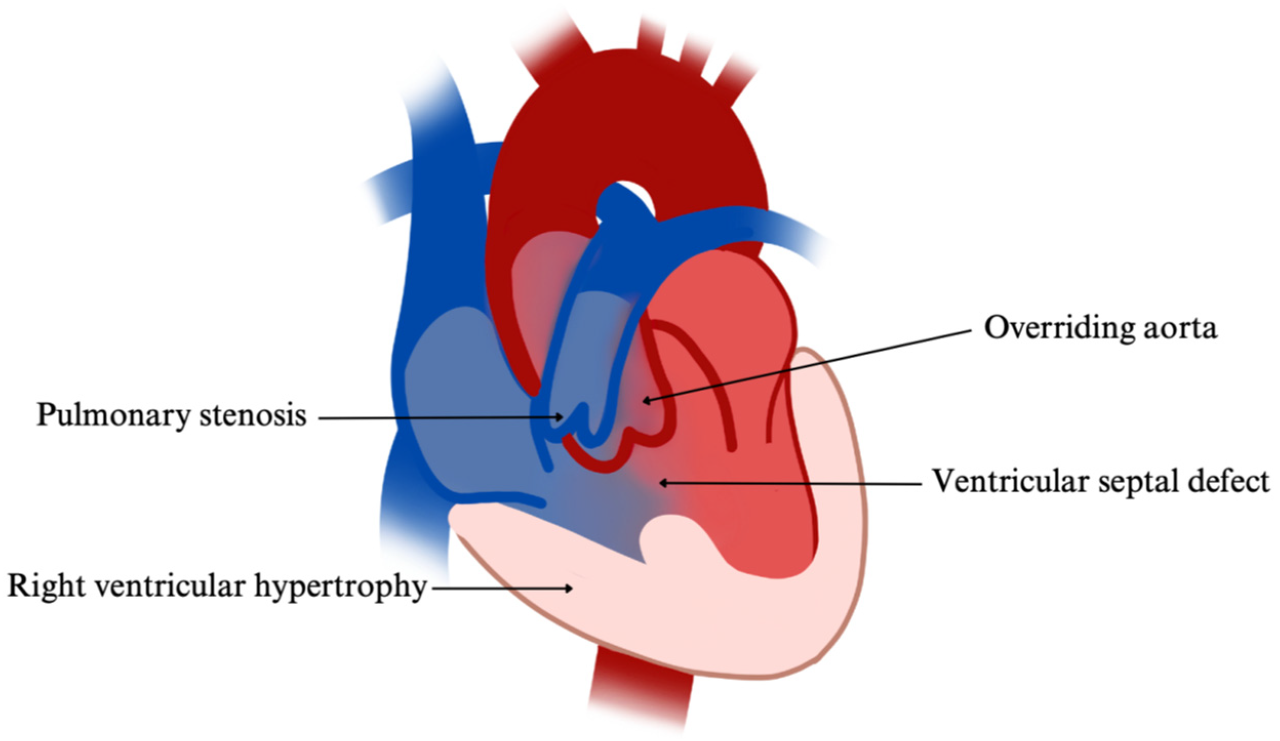 Cardiogenetics 15 00029 g008 Cardiogenetics 15 00029 g008