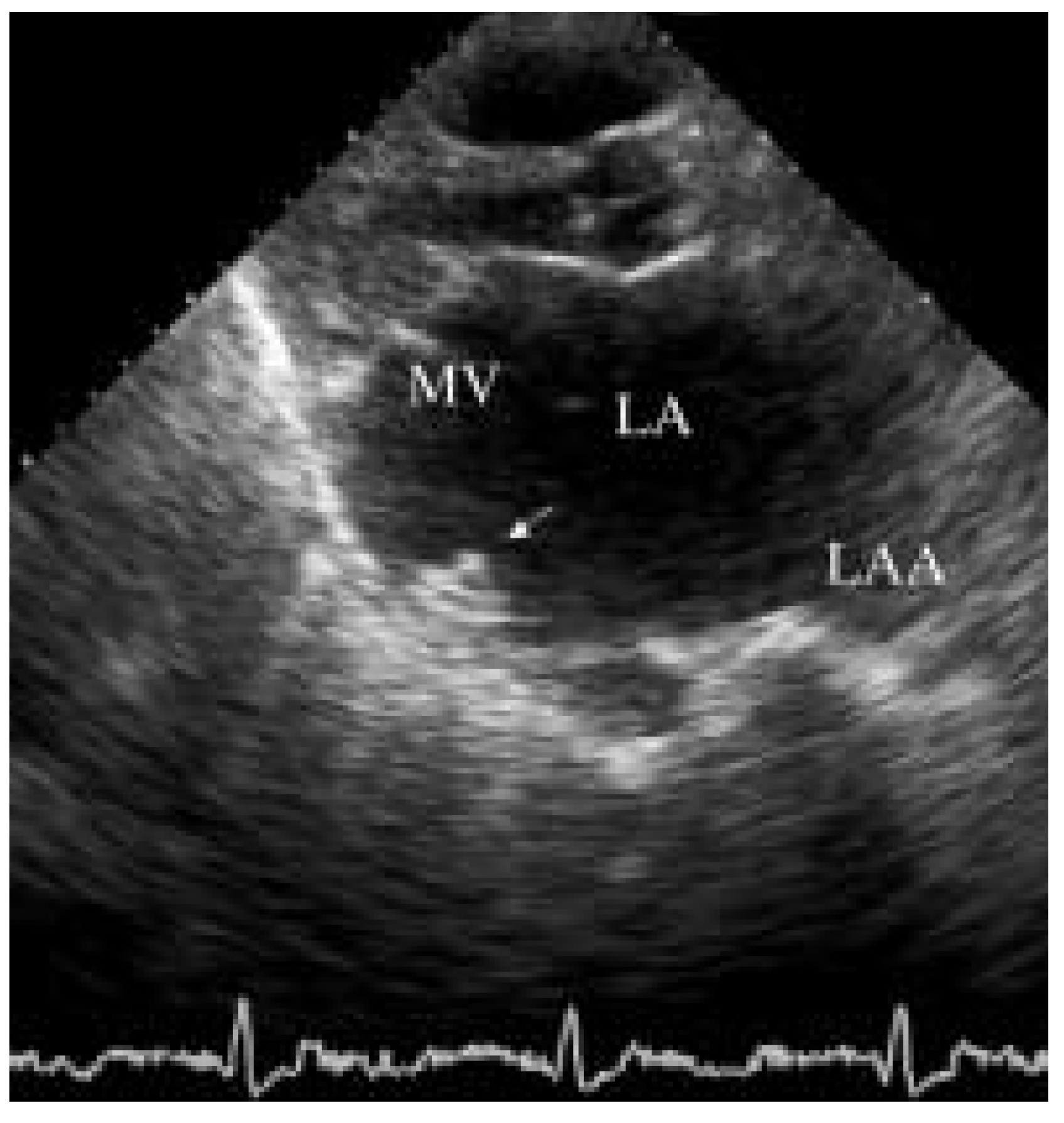 Cardiovascmed 07 00033 g002