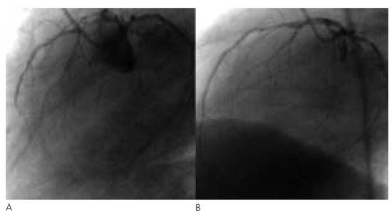 Cardiovascmed 07 00221 g001