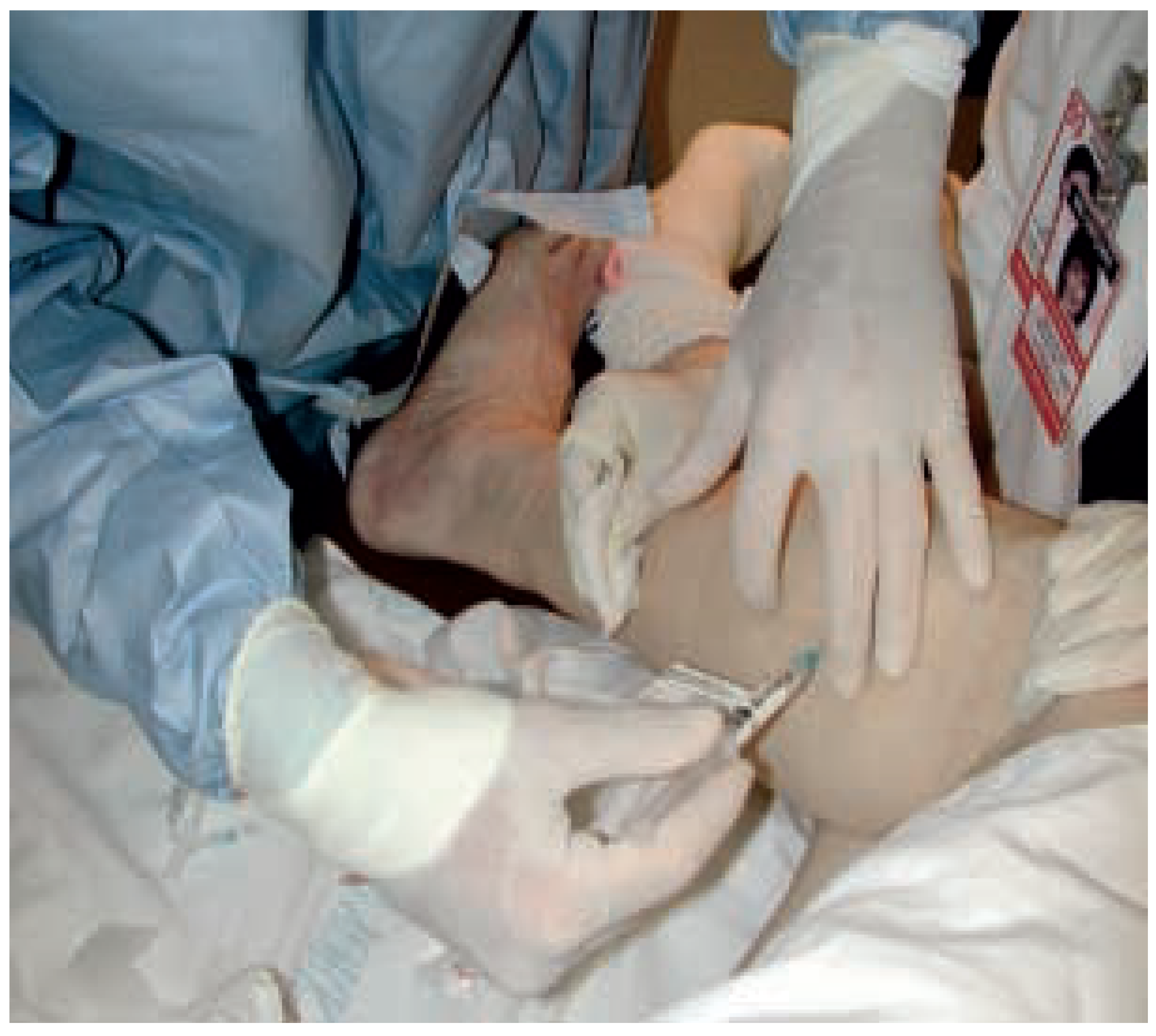 Cardiovascmed 07 00331 g002