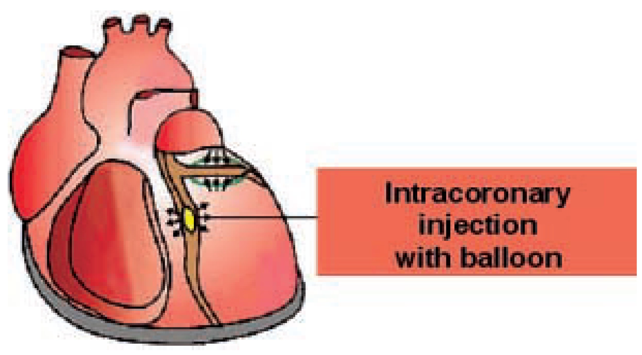 Cardiovascmed 07 00331 g003