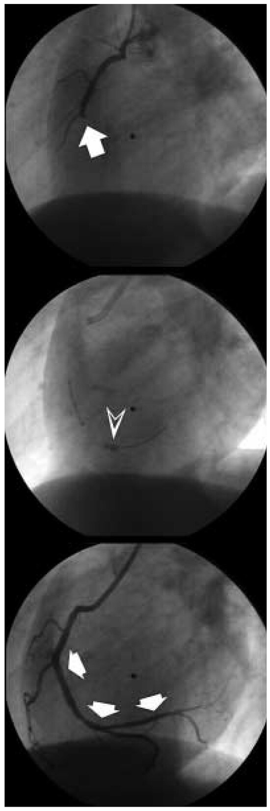 Cardiovascmed 07 00386 g006