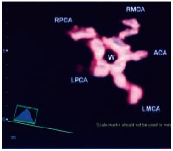 Cardiovascmed 07 00423 g001