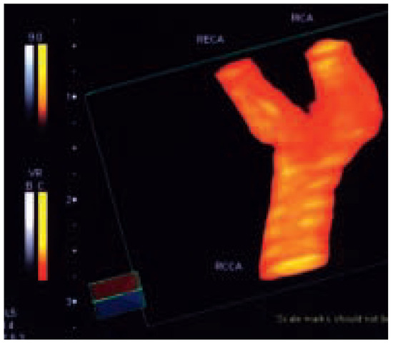 Cardiovascmed 07 00423 g002