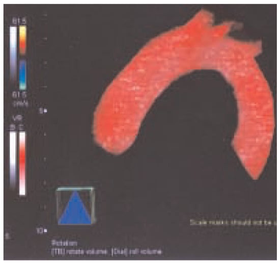 Cardiovascmed 07 00423 g003