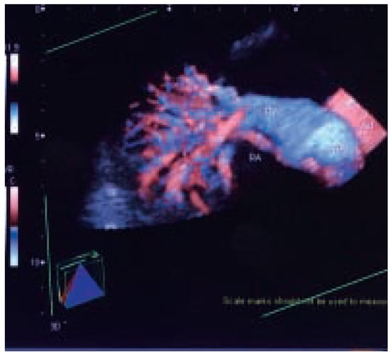 Cardiovascmed 07 00423 g005